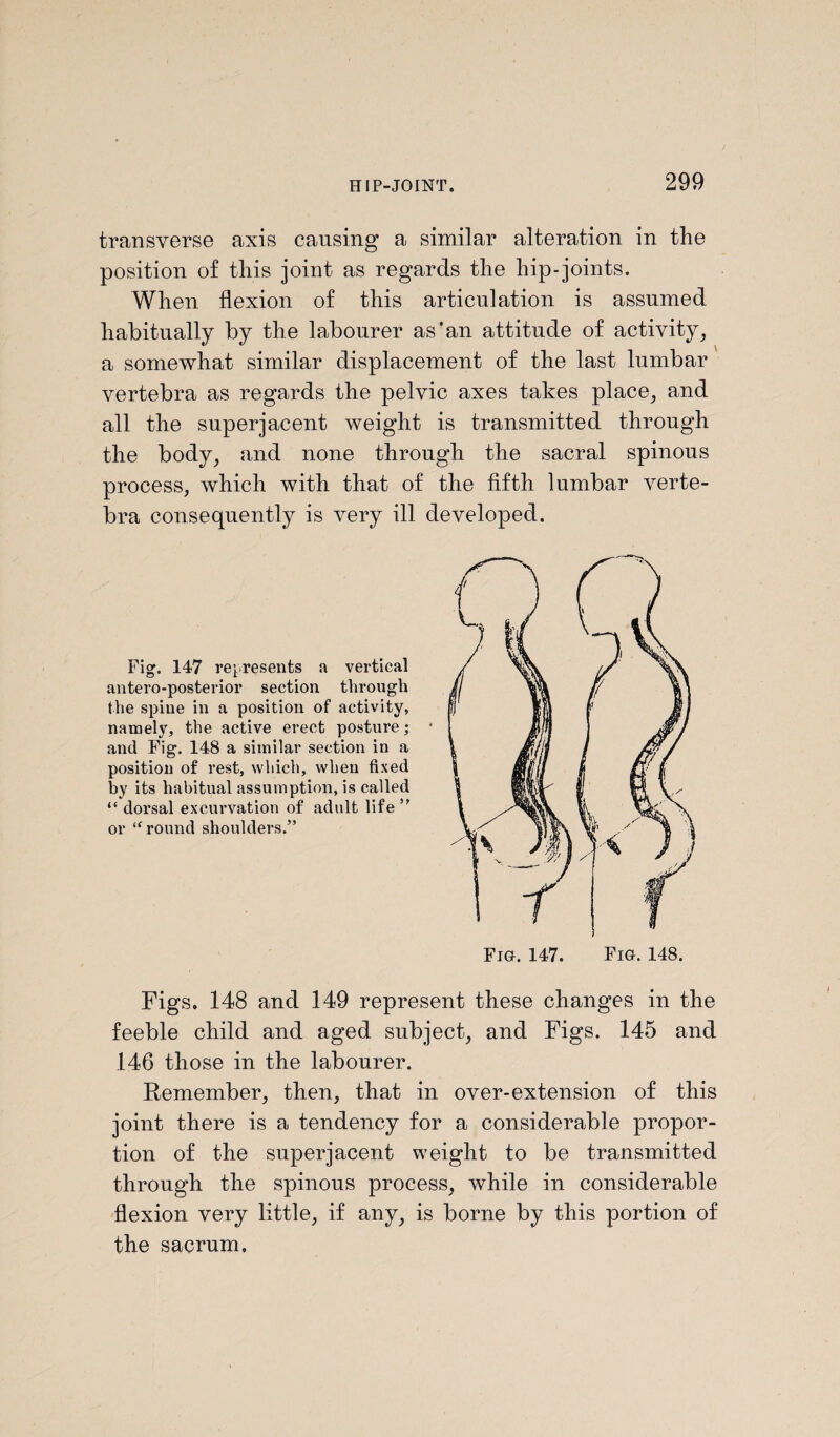 transverse axis causing a similar alteration in the position of this joint as regards the hip-joints. When flexion of this articulation is assumed habitually by the labourer as’an attitude of activity, a somewhat similar displacement of the last lumbar vertebra as regards the pelvic axes takes place, and all the superjacent weight is transmitted through the body, and none through the sacral spinous process, which with that of the fifth lumbar verte¬ bra consequently is very ill developed. Fig. 147 represents a vertical antero-posterior section through the spine in a position of activity, namely, the active erect posture; and Fig. 148 a similar section in a position of rest, which, when fixed by its habitual assumption, is called “ dorsal excurvation of adult life ” or “ round shoulders.” Figs. 148 and 149 represent these changes in the feeble child and aged subject, and Figs. 145 and 146 those in the labourer. Remember, then, that in over-extension of this joint there is a tendency for a considerable propor¬ tion of the superjacent weight to be transmitted through the spinous process, while in considerable flexion very little, if any, is borne by this portion of the sacrum.