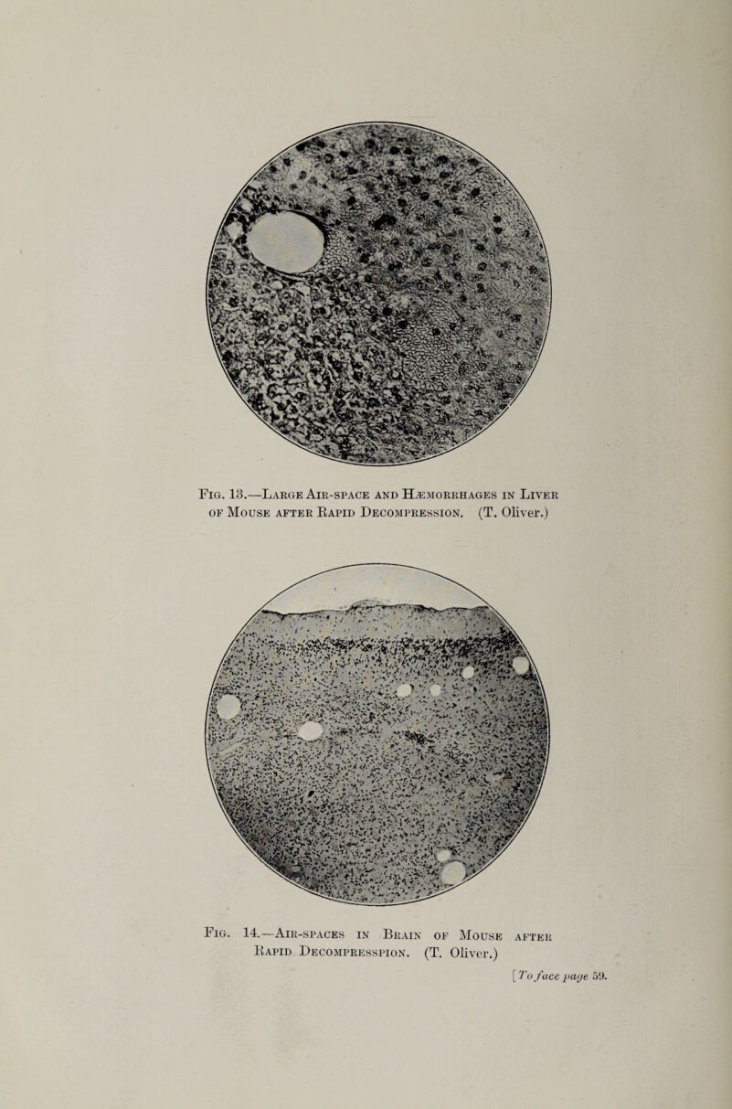 Fig. 13.—Large Air-space and Hemorrhages in Liver of Mouse after Rapid Decompression. (T. Oliver.) Fig. 14.—Air-spaces in Brain of Mouse after Rapid Decompresspion. (T. Oliver.) r.; 'it mm [ To face i>a<jt 51),