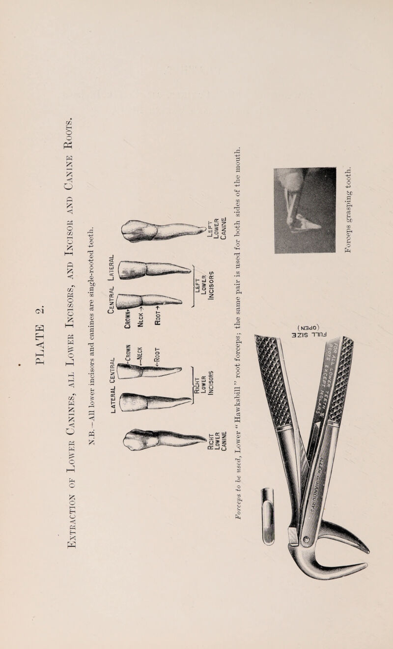 ci H hp Ph m O o Ph p g S <5 o p £ p o 02 P P P c *o cn P £ 4^> CD CD 4^ P 0> 4-i o o u I a> r—< be <D u c3 <D Cj a P S c3 fH o co • r—l O £ <D > I PQ ft P O £ a i—i En O < P En P W (N3dO) Forceps grasping tooth.