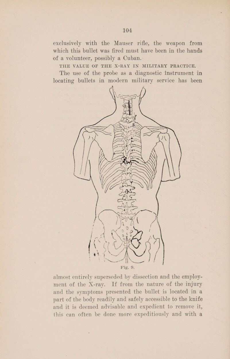 exclusively with the Mauser rifle, the weapon from which this bullet was fired must have been in the hands of a volunteer, possibly a Cuban. THE VALUE OF THE X-RAY IX MILITARY PRACTICE. The use of the probe as a diagnostic instrument in locating bullets in modern military service has been almost entirely superseded by dissection and the employ¬ ment of the X-ray. If from the nature of the injury and the symptoms presented the bullet is located in a part of the body readily and safely accessible to the knife and it is deemed advisable and expedient to remove it, ibis can often be done more expeditiously and with a