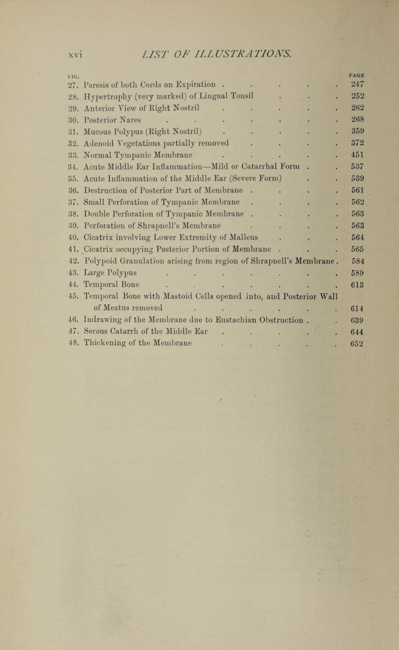 FIG. PAGE 27. Paresis of both Cords on Expiration ..... 247 28. Hypertrophy (very marked) of Lingual Tonsil . . . 252 29. Anterior View of Right Nostril ..... 262 30. Posterior Nares ....... 268 31. Mucous Polypus (Right Nostril) ..... 359 32. Adenoid Vegetations partially removed . . . .372 33. Normal Tympanic Membrane ..... 451 34. Acute Middle Ear Inflammation—Mild or Catarrhal Form . . 537 35. Acute Inflammation of the Middle Ear (Severe Form) . . 539 36. Destruction of Posterior Part of Membrane .... 561 37. Small Perforation of Tympanic Membrane .... 562 38. Double Perforation of Tympanic Membrane .... 563 39. Perforation of Shrapnell’s Membrane .... 563 40. Cicatrix involving Lower Extremity of Malleus . . . 564 41. Cicatrix occupying Posterior Portion of Membrane . . . 565 42. Polypoid Granulation arising from region of ShrapnelPs Membrane . 584 43. Large Polypus ....... 589 44. Temporal Bone . . . . . . .613 45. Temporal Bone with Mastoid Cells opened into, and Posterior Wall of Meatus removed ...... 614 46. Indrawing of the Membrane due to Eustachian Obstruction . . 639 47. Serous Catarrh of the Middle Ear . . . . .644 48. Thickening of the Membrane ..... 652