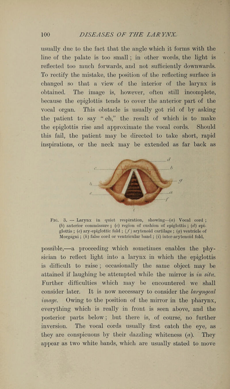 usually due to the fact that the angle which it forms with the line of the palate is too small; in other words, the light is reflected too much forwards, and not sufficiently downwards. To rectify the mistake, the position of the reflecting surface is changed so that a view of the interior of the larynx is obtained. The image is, however, often still incomplete, because the epiglottis tends to cover the anterior part of the vocal organ. This obstacle is usually got rid of by asking the patient to say “ eh,” the result of which is to make the epiglottis rise and approximate the vocal cords. Should this fail, the patient may he directed to take short, rapid inspirations, or the neck may be extended as far back as Fig. 3. — Larynx in quiet respiration, showing—(a) Vocal corcl ; (&) anterior commissure ; (c) region of cushion of epiglottis ; (<d) epi¬ glottis ; (e) ary-epiglottic fold ; (/) arytenoid cartilage ; (g) ventricle of Morgagni; (li) false cord or ventricular band ; (i) inter-arytenoid fold. possible,—a proceeding which sometimes enables the phy¬ sician to reflect light into a larynx in which the epiglottis is difficult to raise ; occasionally the same object may be attained if laughing be attempted while the mirror is in situ. Further difficulties which may be encountered we shall consider later. It is now necessary to consider the laryngeal image. Owing to the position of the mirror in the pharynx, everything which is really in front is seen above, and the posterior parts below; but there is, of course, no further inversion. The vocal cords usually first catch the eye, as they are conspicuous by their dazzling whiteness («). They appear as two white bands, which are usually stated to move