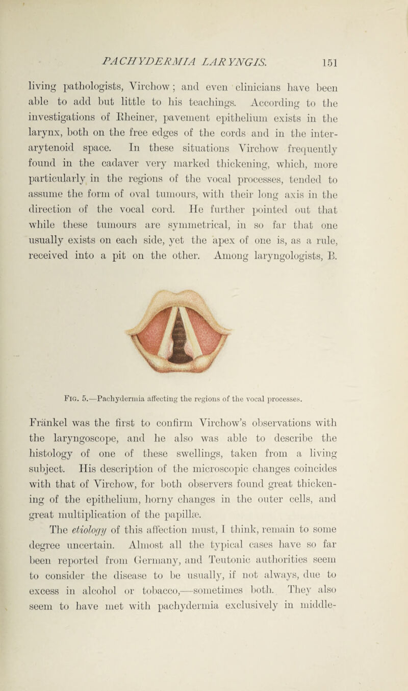 living pathologists, Virchow; and even clinicians have been able to add but little to his teachings. According to the investigations of Itheiner, pavement epithelium exists in the larynx, both on the free edges of the cords and in the inter¬ arytenoid space. In these situations Virchow frequently found in the cadaver very marked thickening, which, more particularly in the regions of the vocal processes, tended to assume the form of oval tumours, with their long axis in the direction of the vocal cord. He further pointed out that while these tumours are symmetrical, in so far that one usually exists on each side, yet the apex of one is, as a rule, received into a pit on the other. Among laryngologists, B. Fig. 5.—Pachydermia affecting the regions of the vocal processes. Frankel was the first to confirm Virchow’s observations with the laryngoscope, and he also was able to describe the histology of one of these swellings, taken from a living subject. His description of the microscopic changes coincides with that of Virchow, for both observers found great thicken¬ ing of the epithelium, horny changes in the outer cells, and great multiplication of the papillae. The etiology of this affection must, I think, remain to some degree uncertain. Almost all the typical cases have so far been reported from Germany, and Teutonic authorities seem to consider the disease to be usually, if not always, due to excess in alcohol or tobacco,—sometimes both. They also seem to have met with pachydermia exclusively in middle-