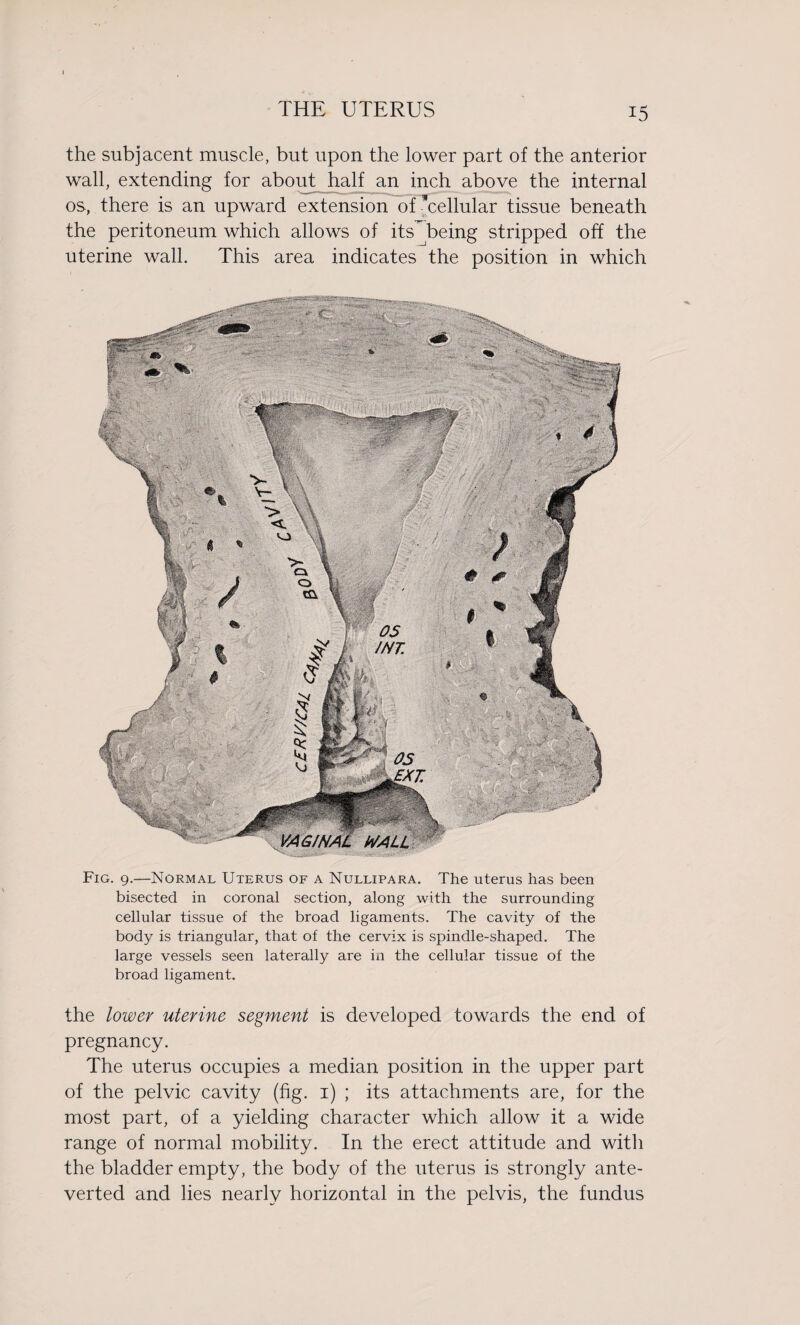 the subjacent muscle, but upon the lower part of the anterior wall, extending for about half an inch above the internal os, there is an upward extension of cellular tissue beneath the peritoneum which allows of its^being stripped off the uterine wall. This area indicates the position in which Fig. 9.—Normal Uterus of a Nullipara. The uterus has been bisected in coronal section, along with the surrounding cellular tissue of the broad ligaments. The cavity of the body is triangular, that of the cervix is spindle-shaped. The large vessels seen laterally are in the cellular tissue of the broad ligament. the lower uterine segment is developed towards the end of pregnancy. The uterus occupies a median position in the upper part of the pelvic cavity (fig. 1) ; its attachments are, for the most part, of a yielding character which allow it a wide range of normal mobility. In the erect attitude and with the bladder empty, the body of the uterus is strongly ante- verted and lies nearly horizontal in the pelvis, the fundus