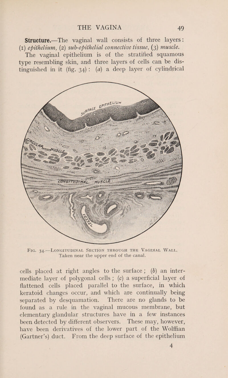 Structure.—The vaginal wall consists of three layers: (i) epithelium, (2) sub-epithelial connective tissue, (3) muscle. The vaginal epithelium is of the stratified squamous type resembling skin, and three layers of cells can be dis¬ tinguished in it (fig. 34) : [a) a deep layer of cylindrical Fig. 34.—Longitudinal Section through the Vaginal Wall. Taken near the upper end of the canal. cells placed at right angles to the surface ; (b) an inter¬ mediate layer of polygonal cells ; (c) a superficial layer of flattened cells placed parallel to the surface, in which keratoid changes occur, and which are continually being separated by desquamation. There are no glands to be found as a rule in the vaginal mucous membrane, but elementary glandular structures have in a few instances been detected by different observers. These may, however, have been derivatives of the lower part of the Wolffian (Gartner’s) duct. From the deep surface of the epithelium 4