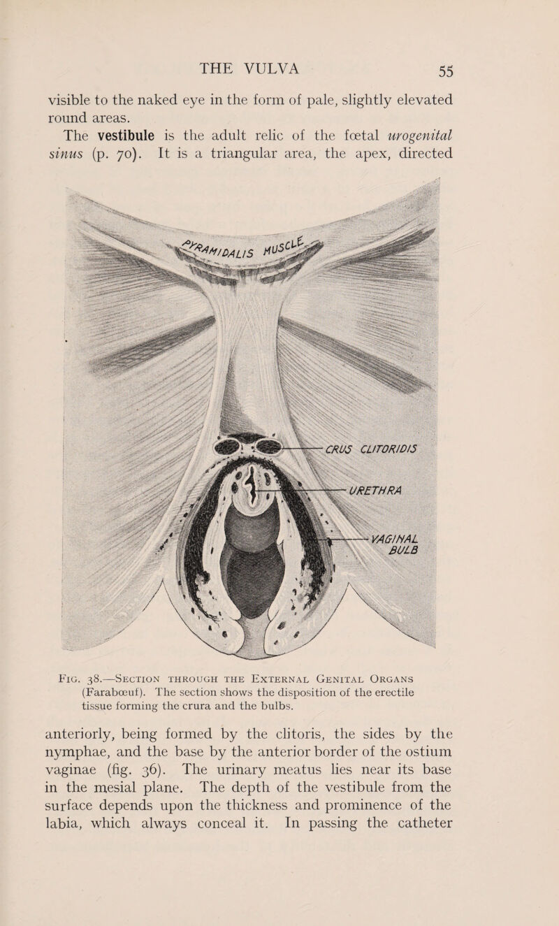 visible to the naked eye in the form of pale, slightly elevated round areas. The vestibule is the adult relic of the foetal urogenital sinus (p. 70). It is a triangular area, the apex, directed CRUS CUT0R1D15 URETHRA VAGINAL BULB Fig. 38.—Section through the External Genital Organs (Farabceuf). The section shows the disposition of the erectile tissue forming the crura and the bulbs. anteriorly, being formed by the clitoris, the sides by the nymphae, and the base by the anterior border of the ostium vaginae (fig. 36). The urinary meatus lies near its base in the mesial plane. The depth of the vestibule from the surface depends upon the thickness and prominence of the labia, which always conceal it. In passing the catheter