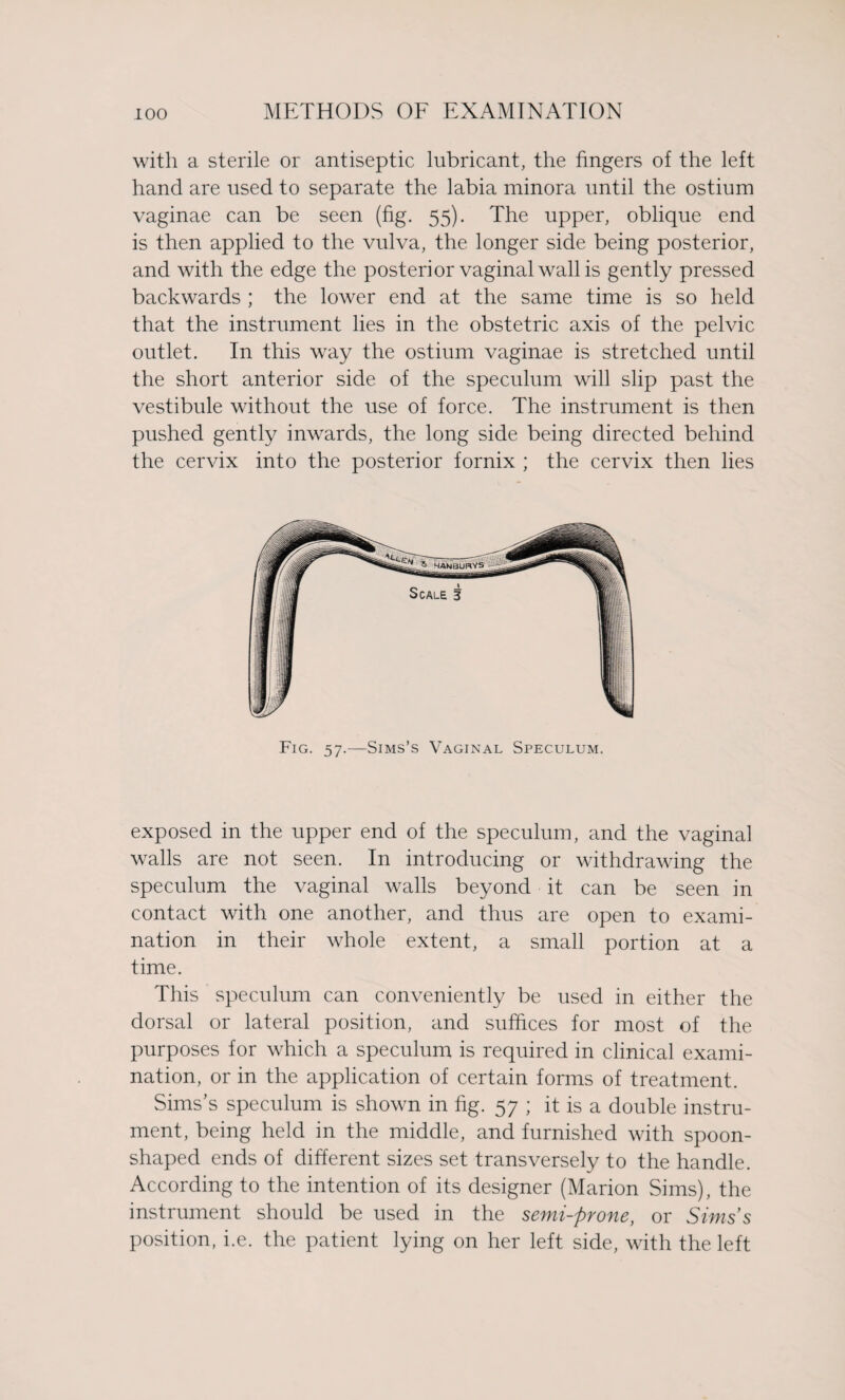 with a sterile or antiseptic lubricant, the fingers of the left hand are used to separate the labia minora until the ostium vaginae can be seen (fig. 55). The upper, oblique end is then applied to the vulva, the longer side being posterior, and with the edge the posterior vaginal wall is gently pressed backwards ; the lower end at the same time is so held that the instrument lies in the obstetric axis of the pelvic outlet. In this way the ostium vaginae is stretched until the short anterior side of the speculum will slip past the vestibule without the use of force. The instrument is then pushed gently inwards, the long side being directed behind the cervix into the posterior fornix ; the cervix then lies Fig. 57.—Sims’s Vaginal Speculum. exposed in the upper end of the speculum, and the vaginal walls are not seen. In introducing or withdrawing the speculum the vaginal walls beyond it can be seen in contact with one another, and thus are open to exami¬ nation in their whole extent, a small portion at a time. This speculum can conveniently be used in either the dorsal or lateral position, and suffices for most of the purposes for which a speculum is required in clinical exami¬ nation, or in the application of certain forms of treatment. Sims’s speculum is shown in fig. 57 ; it is a double instru¬ ment, being held in the middle, and furnished with spoon¬ shaped ends of different sizes set transversely to the handle. According to the intention of its designer (Marion Sims), the instrument should be used in the semi-prone, or Simss position, i.e. the patient lying on her left side, with the left