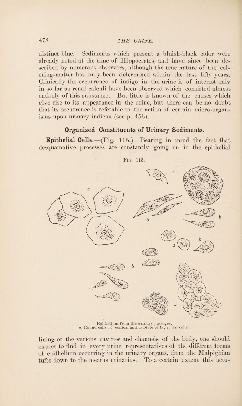 distinct bine. Sediments which present a bluish-black color were already noted at the time of Hippocrates, and have since been de¬ scribed by numerous observers, although the true nature of the col¬ oring-matter has only been determined within the last fifty years. Clinically the occurrence of indigo in the urine is of interest only in so far as renal calculi have been observed which consisted almost entirelv of this substance. But little is known of the causes which give rise to its appearance in the urine, but there can be no doubt that its occurrence is referable to the action of certain micro-organ¬ isms upon urinary indican (see p. 456). Organized Constituents of Urinary Sediments. Epithelial Cells.—(Fig. 115.) Bearing in mind the fact that desquamative processes are constantly going on in the epithelial Fig. 115. Epithelium from the urinary passages. a, Round cells ; b, conical and caudate cells ; c, flat cells. lining of the various cavities and channels of the body, one should expect to find in every urine representatives of the different forms of epithelium occurring in the urinary organs, from the Malpighian tufts down to the meatus urinarius. To a certain extent this actu-