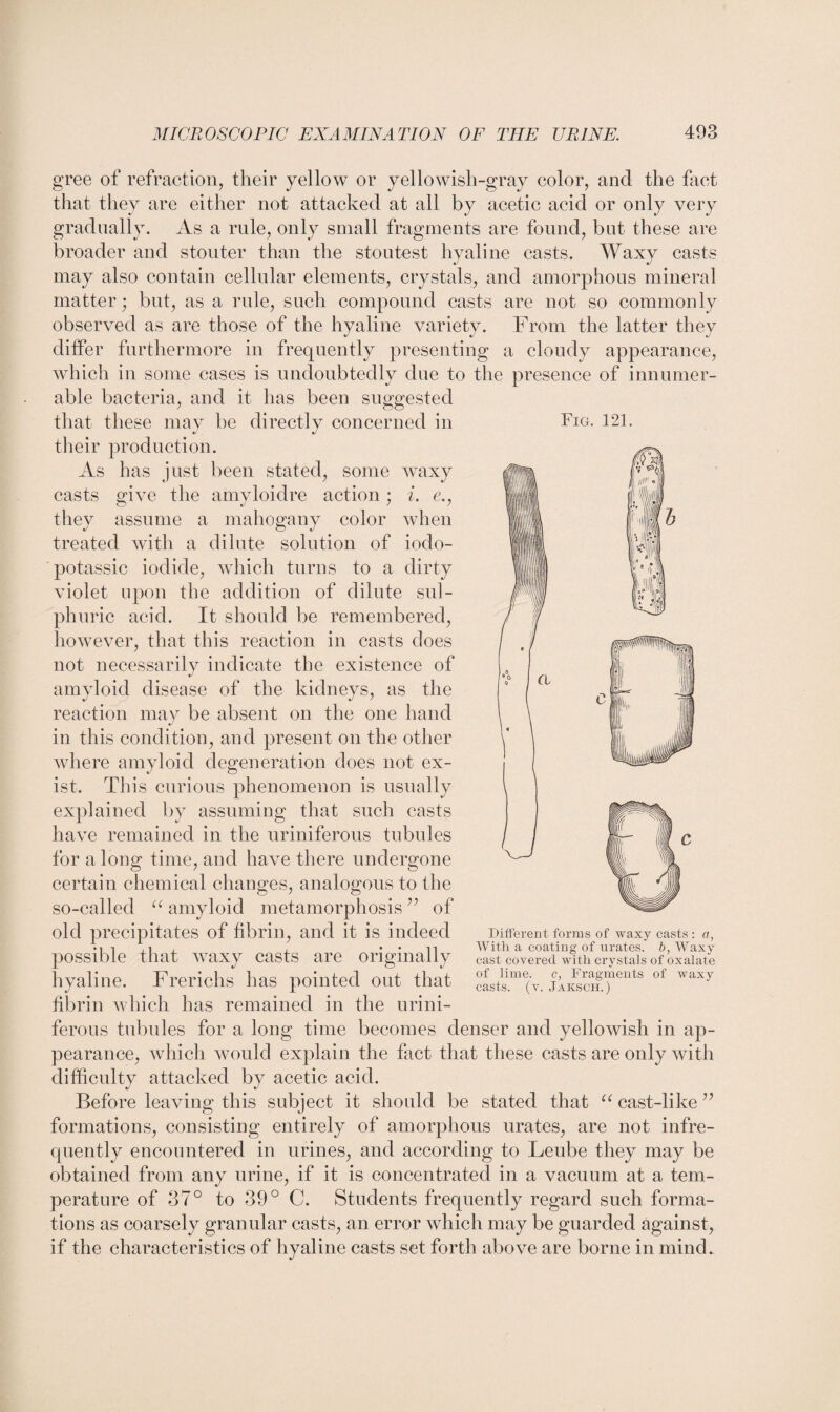 Fig. 121. gree of refraction, their yellow or yellowish-gray color, and the fact that they are either not attacked at all by acetic acid or only very gradually. As a rule, only small fragments are found, but these are broader and stouter than the stoutest hyaline casts. Waxy casts may also contain cellular elements, crystals, and amorphous mineral matter; but, as a rule, such compound casts are not so commonly observed as are those of the hyaline variety. From the latter they differ furthermore in frequently presenting a cloudy appearance, which in some cases is undoubtedly due to the presence of innumer¬ able bacteria, and it has been suggested that these may be directly concerned in their production. As has just been stated, some waxy casts give the amyloidre action; i. e., they assume a mahogany color when treated with a dilute solution of iodo- potassic iodide, which turns to a dirty violet upon the addition of dilute sul¬ phuric acid. It should be remembered, however, that this reaction in casts does not necessarily indicate the existence of amyloid disease of the kidneys, as the reaction may be absent on the one hand in this condition, and present on the other where amyloid degeneration does not ex¬ ist. This curious phenomenon is usually explained by assuming that such casts have remained in the uriniferous tubules for a long time, and have there undergone certain chemical changes, analogous to the so-called “ amyloid metamorphosis ” of old precipitates of fibrin, and it is indeed possible that waxy casts are originally hyaline. Frerichs has pointed out that fibrin which has remained in the urini¬ ferous tubules for a long time becomes denser and yellowish in ap¬ pearance, which would explain the fact that these casts are only with difficulty attacked by acetic acid. Before leaving this subject it should be stated that u cast-like ” formations, consisting entirely of amorphous urates, are not infre¬ quently encountered in urines, and according to Leube they may be obtained from any urine, if it is concentrated in a vacuum at a tem¬ perature of 37° to 39° C. Students frequently regard such forma¬ tions as coarsely granular casts, an error which may be guarded against, if the characteristics of hyaline casts set forth above are borne in mind. Different forms of waxy casts : a, With a coating of urates, b, Waxy cast covered with crystals of oxalate of lime, c, Fragments of waxy casts, (v. Jaksch.)