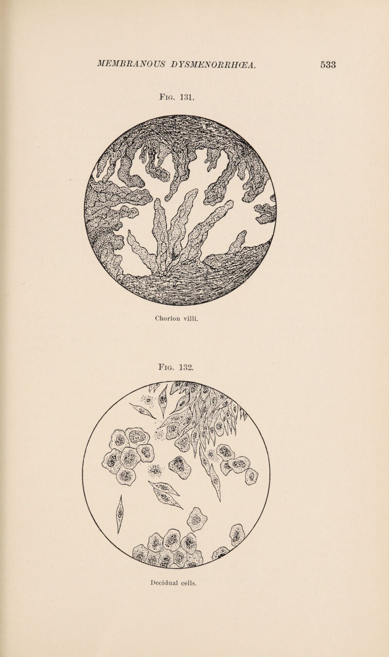 Fig. 131. Chorion villi. Fig. 132. Decidual cells