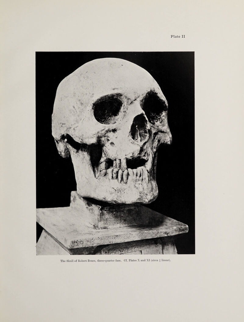 The Skull of Robert Bruce, three-quarter face. Cf. Plates X and XI (circa § linear)