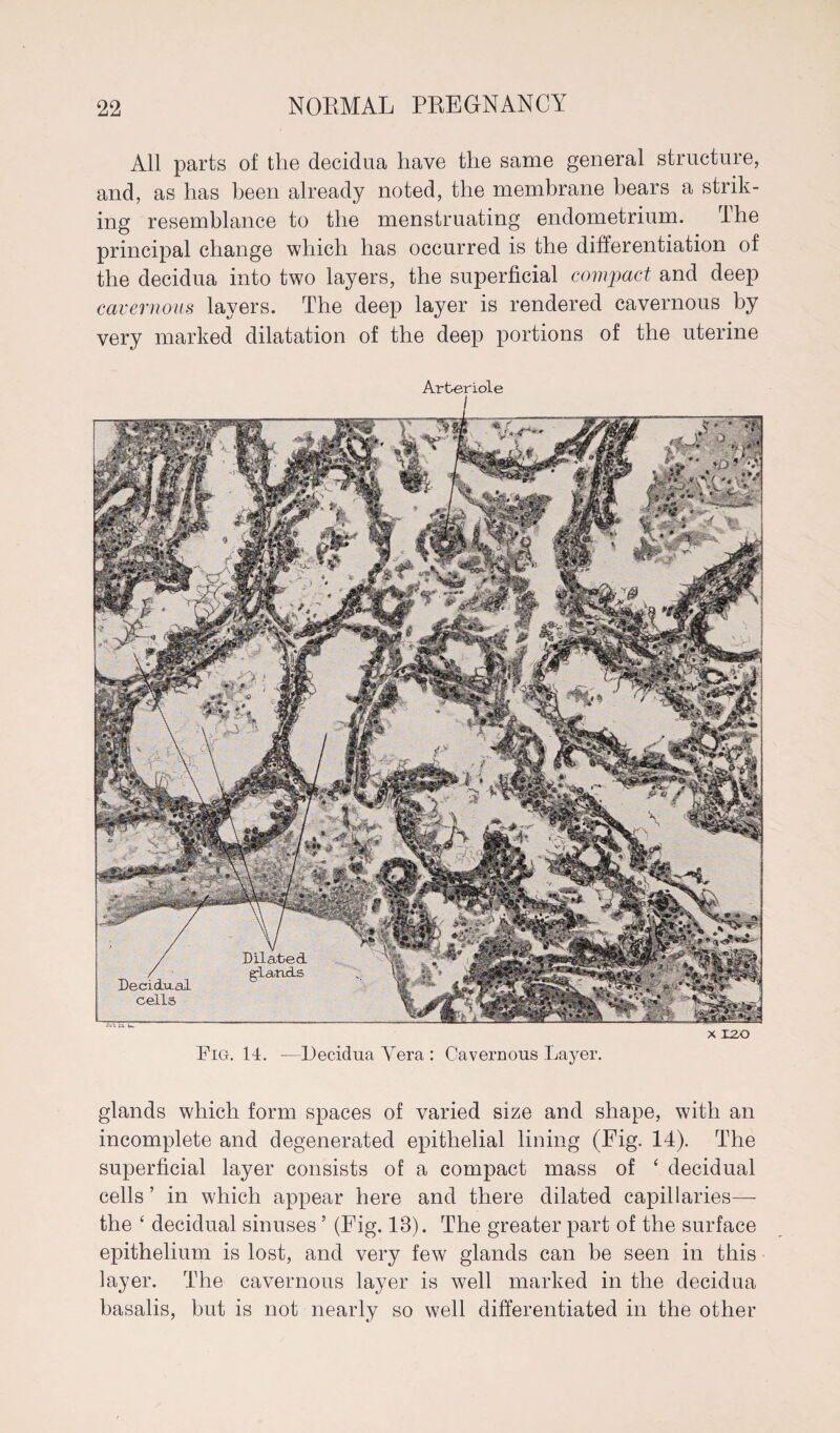 All parts of the decidua have the same general structure, and, as has been already noted, the membrane bears a strik¬ ing resemblance to the menstruating endometrium. rIhe principal change which has occurred is the differentiation of the decidua into two layers, the superficial compact and deep cavernous layers. The deep layer is rendered cavernous by very marked dilatation of the deep portions of the uterine Arteriole I glands which form spaces of varied size and shape, with an incomplete and degenerated epithelial lining (Fig. 14). The superficial layer consists of a compact mass of ‘ decidual cells ’ in which appear here and there dilated capillaries— the ‘ decidual sinuses ’ (Fig. 13). The greater part of the surface epithelium is lost, and very few glands can be seen in this layer. The cavernous layer is well marked in the decidua basalis, but is not nearly so well differentiated in the other