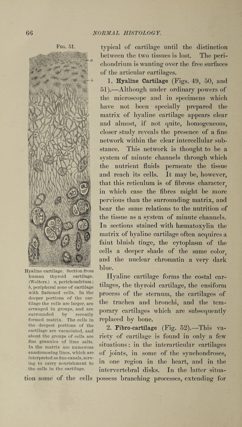 Fig. 51. Hyaline cartilage. Section from human thyroid cartilage. (Wolters.) a, perichondrium; b, peripheral zone of cartilage with flattened cells. In the deeper portions of the car¬ tilage the cells are larger, are arranged in groups, and are surrounded by recently formed matrix. The cells in the deepest portions of the cartilage are vacuolated, and about the groups of cells are fine granules of lime salts. In the matrix are numerous anastomosing lines, which are interpreted as fine canals, serv¬ ing to carry nourishment to the cells in the cartilage. typical of cartilage until the distinction between the two tissues is lost. The peri¬ chondrium is wanting over the free surfaces of the articular cartilages. 1. Hyaline Cartilage (Figs. 49, 50, and 51).—Although under ordinary powers of the microscope and in specimens which have not been specially prepared the matrix of hyaline cartilage appears clear and almost, if not quite, homogeneous, closer study reveals the presence of a fine network within the clear intercellular sub¬ stance. This network is thought to be a system of minute channels through which the nutrient fluids permeate the tissue and reach its cells. It may be, however, that this reticulum is of fibrous character in which case the fibres might be more pervious than the surrounding matrix, and bear the same relations to the nutrition of the tissue as a system of minute channels. In sections stained with hsematoxylin the matrix of hyaline cartilage often acquires a faint bluish tinge, the cytoplasm of the cells a deeper shade of the same color? and the nuclear chromatin a very dark blue. Hyaline cartilage forms the costal car¬ tilages, the thyroid cartilage, the ensiform process of the sternum, the cartilages of the trachea and bronchi, and the tem¬ porary cartilages which are subsequently replaced by bone. 2. Fibro-cartilage (Fig. 52).—This va- rietv of cartilage is found in only a few situations : in the interarticular cartilages of joints, in some of the synchondroses, in one region in the heart, and in the intervertebral disks. In the latter situa¬ tion some of the cells possess branching processes, extending for