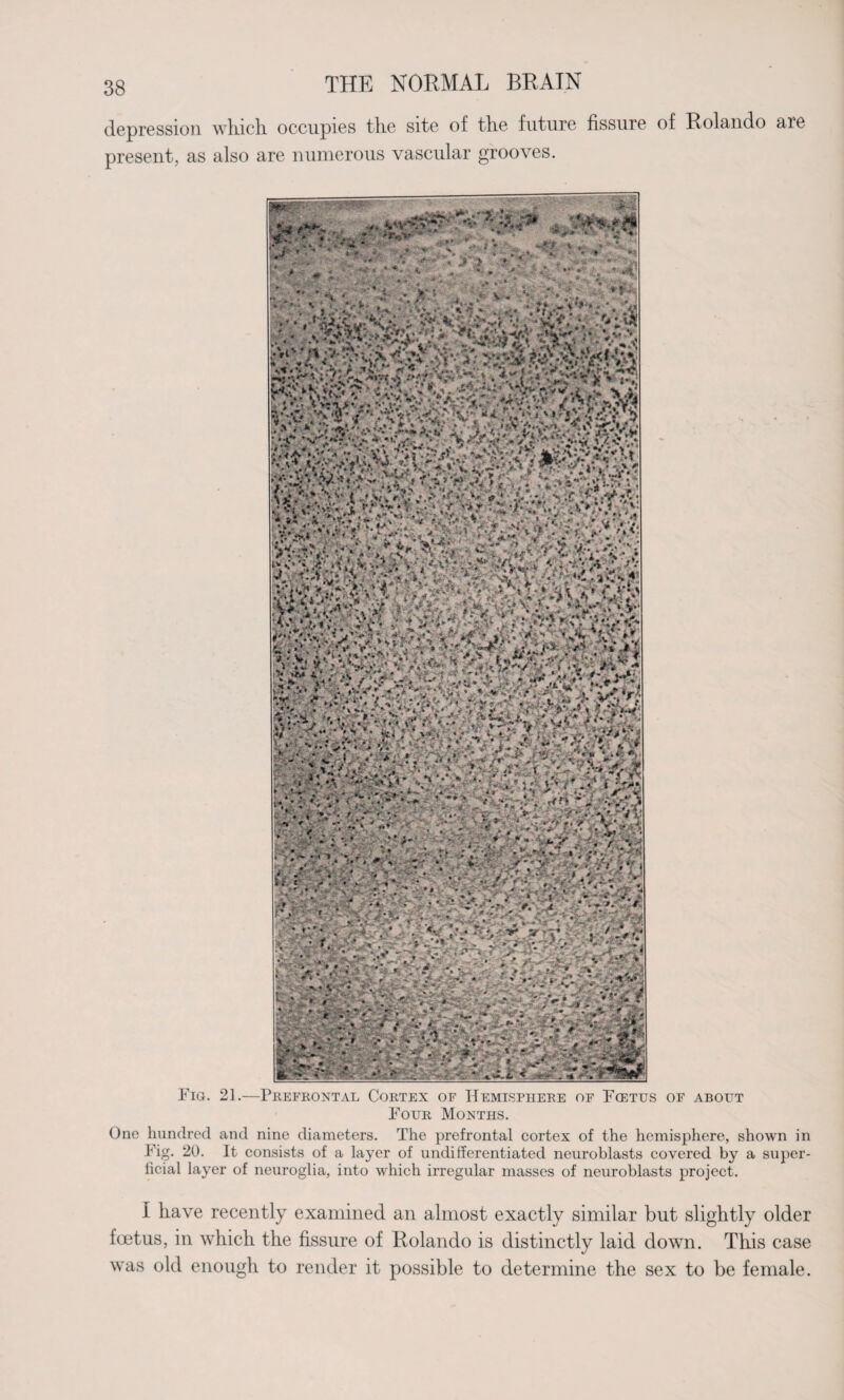 depression which, occupies the site of the future fissure of Rolando are present, as also are numerous vascular grooves. Fig. 21.—Prefrontal Cortex of Hemisphere of Fcetus of about Four Months. One hundred and nine diameters. The prefrontal cortex of the hemisphere, shown in Fig. 20. It consists of a layer of undifferentiated neuroblasts covered by a super¬ ficial layer of neuroglia, into which irregular masses of neuroblasts project. I have recently examined an almost exactly similar but slightly older foetus, in which the fissure of Rolando is distinctly laid down. This case was old enough to render it possible to determine the sex to be female.