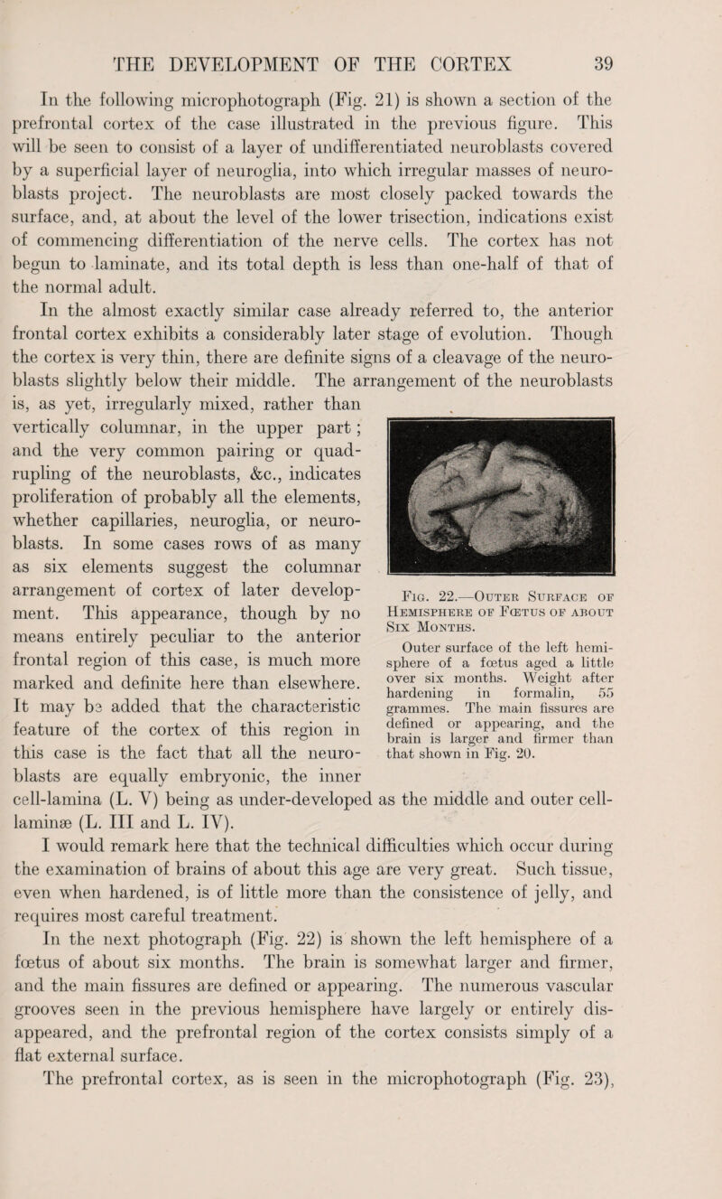 In the following microphotograph (Fig. 21) is shown a section of the prefrontal cortex of the case illustrated in the previous figure. This will be seen to consist of a layer of undifferentiated neuroblasts covered by a superficial layer of neuroglia, into which irregular masses of neuro¬ blasts project. The neuroblasts are most closely packed towards the surface, and, at about the level of the lower trisection, indications exist of commencing differentiation of the nerve cells. The cortex has not begun to laminate, and its total depth is less than one-half of that of the normal adult. In the almost exactly similar case already referred to, the anterior frontal cortex exhibits a considerably later stage of evolution. Though the cortex is very thin, there are definite signs of a cleavage of the neuro¬ blasts slightly below their middle. The arrangement of the neuroblasts is, as yet, irregularly mixed, rather than vertically columnar, in the upper part; and the very common pairing or quad¬ rupling of the neuroblasts, &c., indicates proliferation of probably all the elements, whether capillaries, neuroglia, or neuro¬ blasts. In some cases rows of as many as six elements suggest the columnar arrangement of cortex of later develop¬ ment. This appearance, though by no means entirely peculiar to the anterior frontal region of this case, is much more marked and definite here than elsewhere. It may be added that the characteristic feature of the cortex of this region in this case is the fact that all the neuro- blasts are equally embryonic, the inner cell-lamina (L. V) being as under-developed as the middle and outer cell- laminae (L. Ill and L. IV). I would remark here that the technical difficulties which occur during the examination of brains of about this age are very great. Such tissue, even when hardened, is of little more than the consistence of jelly, and requires most careful treatment. In the next photograph (Fig. 22) is shown the left hemisphere of a foetus of about six months. The brain is somewhat larger and firmer, and the main fissures are defined or appearing. The numerous vascular grooves seen in the previous hemisphere have largely or entirely dis¬ appeared, and the prefrontal region of the cortex consists simply of a flat external surface. The prefrontal cortex, as is seen in the microphotograph (Fig. 23), Fig. 22.-—Outer Surface of Hemisphere of Fcetus of about Six Months. Outer surface of the left hemi¬ sphere of a foetus aged a little over six months. Weight after hardening in formalin, 55 grammes. The main fissures are defined or appearing, and the brain is larger and firmer than that shown in Fig. 20.