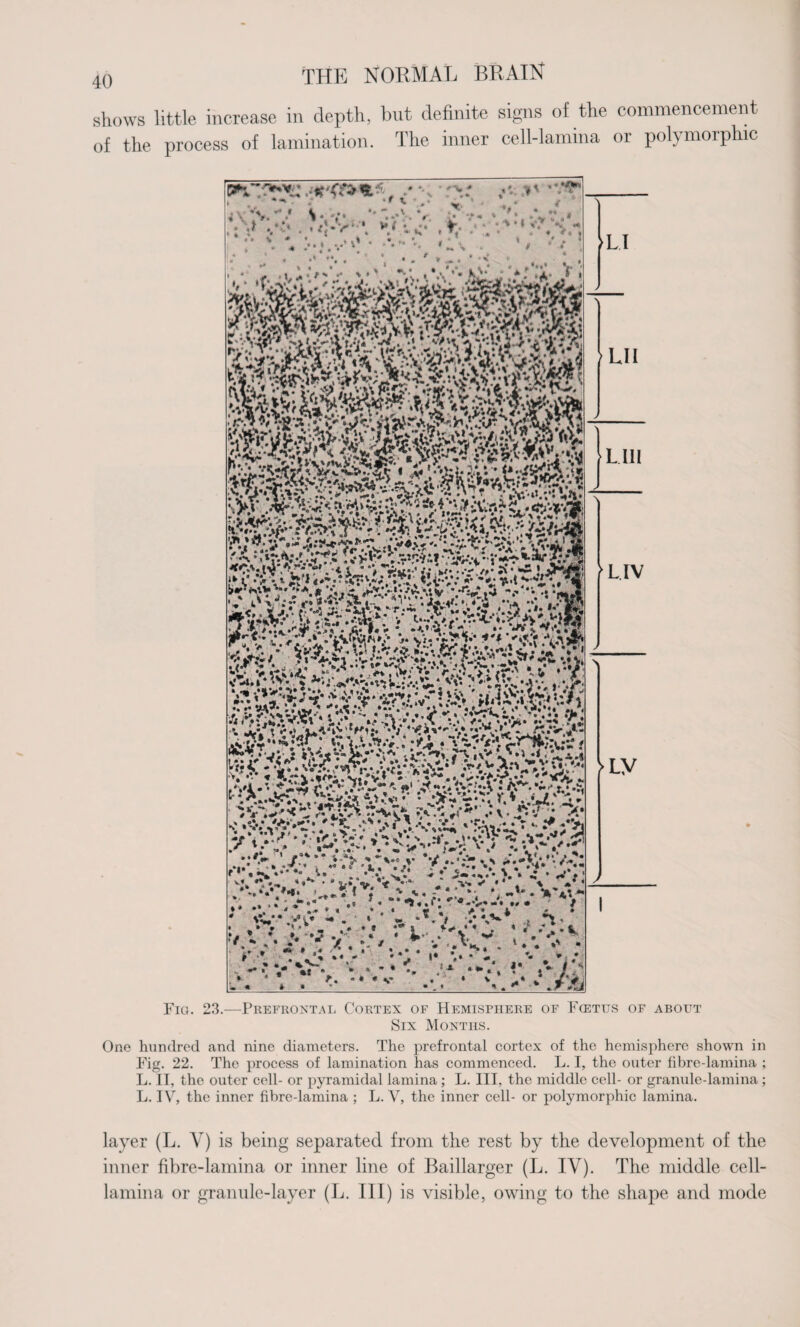 shows little increase in depth, but definite signs of the commencement of the process of lamination. The inner cell-lamina or polymorphic Fig. 23.—Prefrontal Cortex of Hemisphere of Fcettjs of about Six Months. One hundred and nine diameters. The prefrontal cortex of the hemisphere shown in Fig. 22. The process of lamination has commenced. L. I, the outer fibre-lamina ; L. IT, the outer cell- or pyramidal lamina; L. Ill, the middle cell- or granule-lamina; L. IV, the inner fibre-lamina ; L. V, the inner cell- or polymorphic lamina. layer (L. Y) is being separated from the rest by the development of the inner fibre-lamina or inner line of Baillarger (L. IV). The middle cell- lamina or granule-layer (L. Ill) is visible, owing to the shape and mode