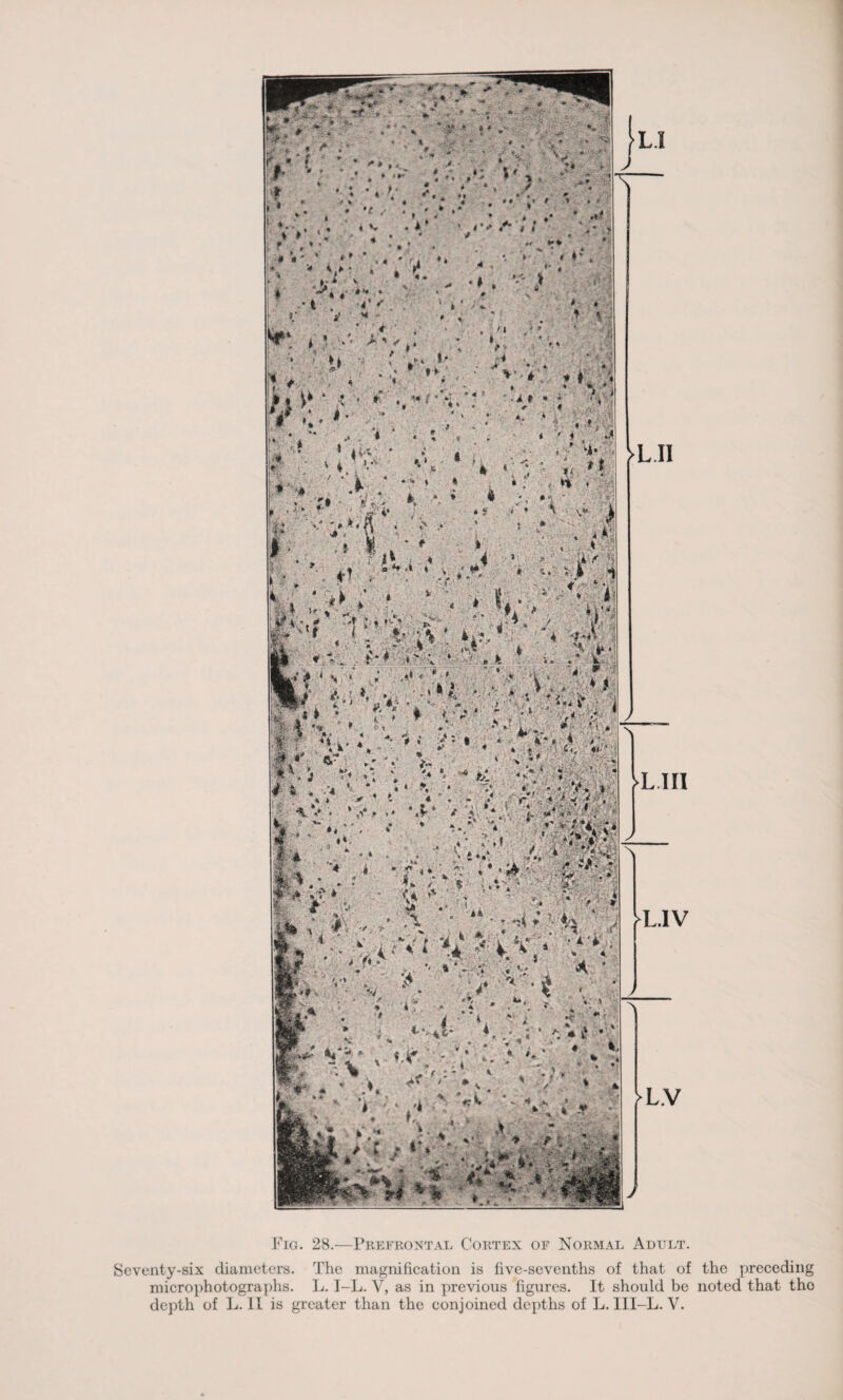 Fig. 28.—Prefrontal Cortex of Normal Adult. Seventy-six diameters. The magnification is five-sevenths of that of the preceding microphotographs. L. I-L. V, as in previous figures. It should be noted that tho