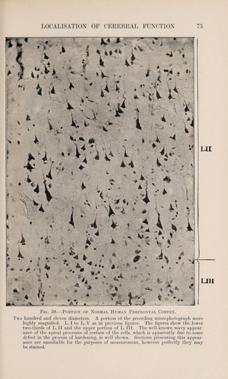 * ■^■Sk. .v'/l! LIE LIII Fig. 39.—Portion of Normal Human Prefrontal Cortex. Two hundred and eleven diameters. A portion of the preceding microphotograph more highly magnified. L. I to L. V as in previous figures. The figures show the lower two-thirds of L. II and the upper portion of L. III. The well-known wavy appear¬ ance of the apical processes of certain of the cells, which is apparently due to some defect in the process of hardening, is well shown. Sections presenting this appear¬ ance are unsuitable for the purposes of measurement, however perfectly they may be stained.
