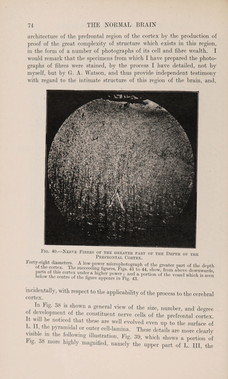 architecture of the prefrontal region of the cortex by the production of proof of the great complexity of structure which exists in this region, in the form of a number of photographs of its cell and fibre wealth. I would remark that the specimens from which I have prepared the photo¬ graphs of fibres were stained, by the process I have detailed, not by myself, but by G. A. Watson, and thus provide independent testimony with regard to the intimate structure of this region of the brain, and, Pig. 40.—Nerve Fibres of the greater part of the Depth of the Prefrontal Cortex. Llow the^entre of ^re'fp^r^ig.la P°rti°n °f ^ TCSSel Whi°h is Sec» incidentally, with respect to the applicability of the process to the cerebral cortex. In Fig. 38 is shown a general view of the size, number, and degree o development of the constituent nerve cells of the prefrontal cortex. It will be noticed that these are well evolved even up to the surface of , ; the Pyaf!fal 01 0,,ter cell-lamina. These details are more clearly visible in the Mowing illustration, Fig. 39, which shows a portion of c. moie lg i \ magnified, namely the upper part of L. Ill, the
