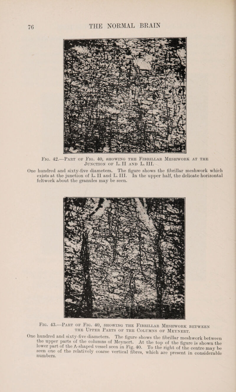 7G Fig. 42.—Part of Fig. 40, showing the Fibrillar Meshwork at the Junction of L. II and L. III. One hundred and sixty-five diameters. The figure shows the fibrillar meshwork which exists at the junction of L. II and L. III. In the upper half, the delicate horizontal feltwork about the granules may be seen. Fig. 43.—Part of Fig. 40, showing the Fibrillar Meshwork between the Upper Parts of the Columns of Meynert. One hundred and sixty-five diameters. The figure shows the fibrillar meshwork between the upper parts ol the columns of Meynert. At the top of the figure is shown the lower part of the A-shaped vessel seen in Fig. 40. To the right of the centre may be seen one of the relatively coarse vertical fibres, which are present in considerable