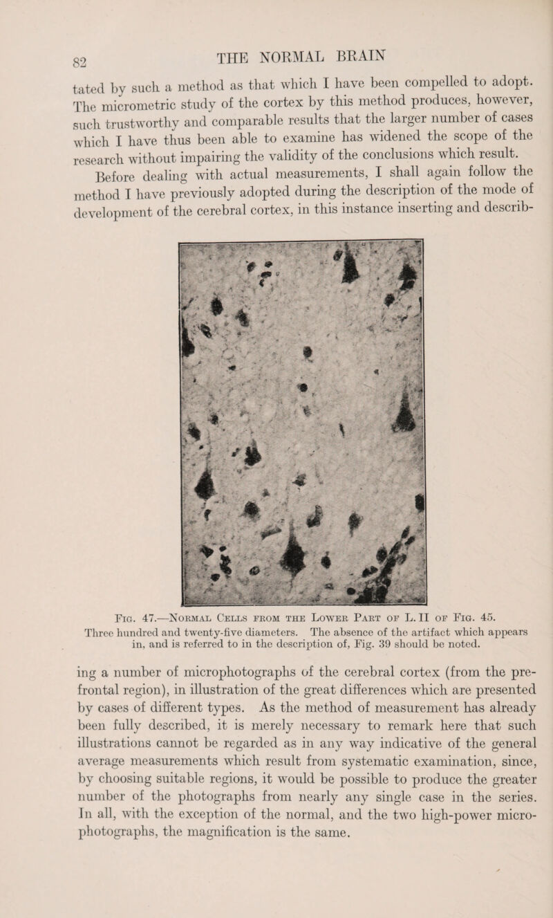tated by such a method as that which I have been compelled to adopt. The micrometric study of the cortex by this method produces, however, such trustworthy and comparable results that the larger number of cases which I have thus been able to examine has widened the scope of the research without impairing the validity of the conclusions which result. Before dealing with actual measurements, I shall again follow the method I have previously adopted during the description of the mode of development of the cerebral cortex, in this instance inserting and describ- Fig. 47.—Normal Cells from the Lower Part of L. II of Fig. 45. Three hundred and twenty-five diameters. The absence of the artifact which appears in, and is referred to in the description of, Fig. 39 should be noted. ing a number of micropliotographs of the cerebral cortex (from the pre¬ frontal region), in illustration of the great differences which are presented by cases of different types. As the method of measurement has already been fully described, it is merely necessary to remark here that such illustrations cannot be regarded as in any way indicative of the general average measurements which result from systematic examination, since, by choosing suitable regions, it would be possible to produce the greater number of the photographs from nearly any single case in the series. In all, with the exception of the normal, and the two high-power micro¬ photographs, the magnification is the same.