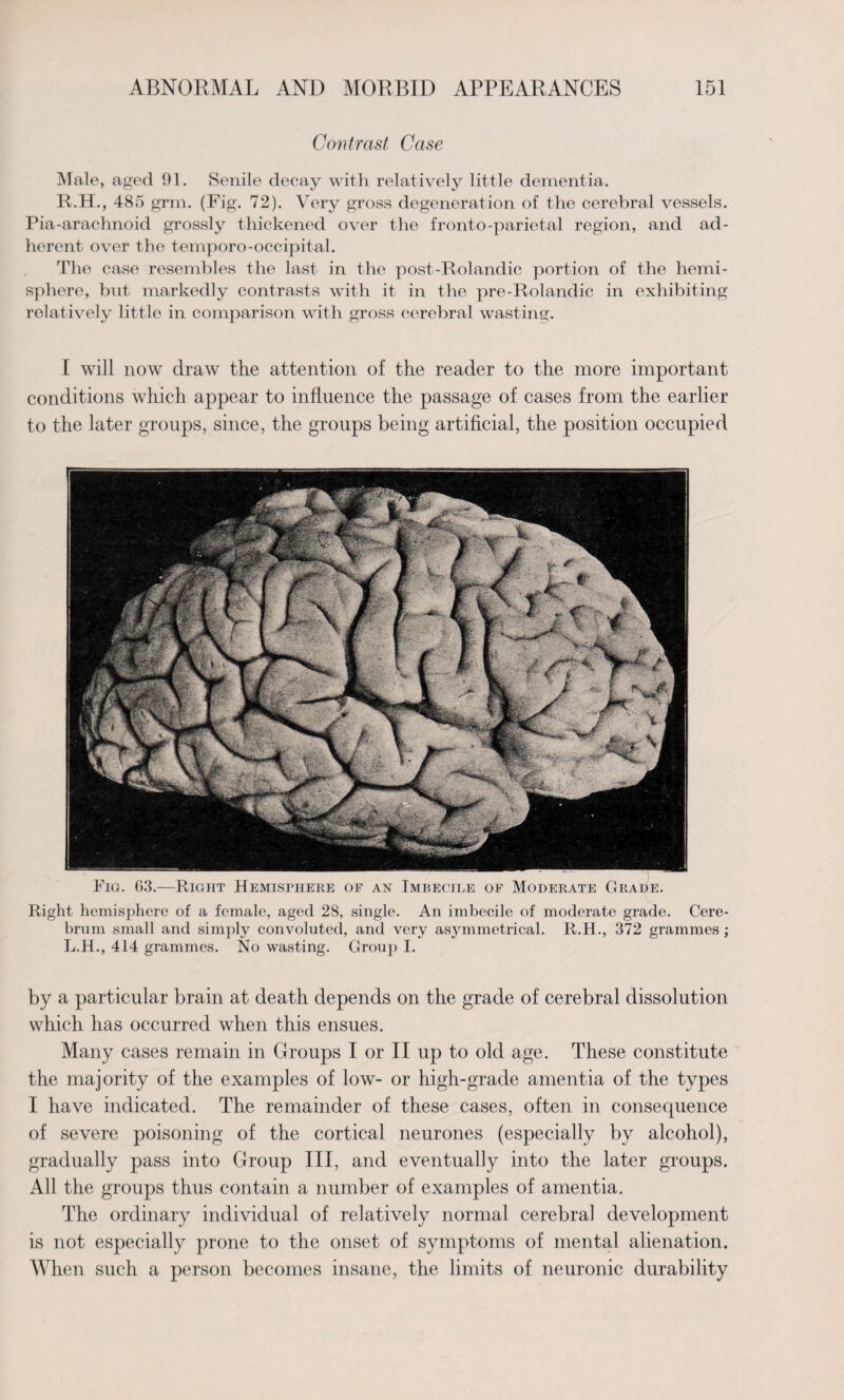 Contrast Case Male, aged 91. Senile decay with relatively little dementia. R.H., 485 grin. (Fig. 72). Very gross degeneration of the cerebral vessels. Pia-arachnoid grossly thickened over the fronto-parietal region, and ad¬ herent over the temporo-occipital. The case resembles the last in the post-Rolandic portion of the hemi¬ sphere, but markedly contrasts with it in the pre-Rolandic in exhibiting relatively little in comparison with gross cerebral wasting. I will now draw tlie attention of the reader to the more important conditions which appear to influence the passage of cases from the earlier to the later groups, since, the groups being artificial, the position occupied Fig. 63.—Right Hemisphere of an Imbecile or Moderate Grade. Right hemisphere of a female, aged 28, single. An imbecile of moderate grade. Cere¬ brum small and simply convoluted, and very asymmetrical. R.H., 372 grammes ; L.H., 414 grammes. No wasting. Group I. by a particular brain at death depends on the grade of cerebral dissolution which has occurred when this ensues. Many cases remain in Groups I or II up to old age. These constitute the majority of the examples of low- or high-grade amentia of the types I have indicated. The remainder of these cases, often in consequence of severe poisoning of the cortical neurones (especially by alcohol), gradually pass into Group III, and eventually into the later groups. All the groups thus contain a number of examples of amentia. The ordinary individual of relatively normal cerebral development is not especially prone to the onset of symptoms of mental alienation. When such a person becomes insane, the limits of neuronic durability