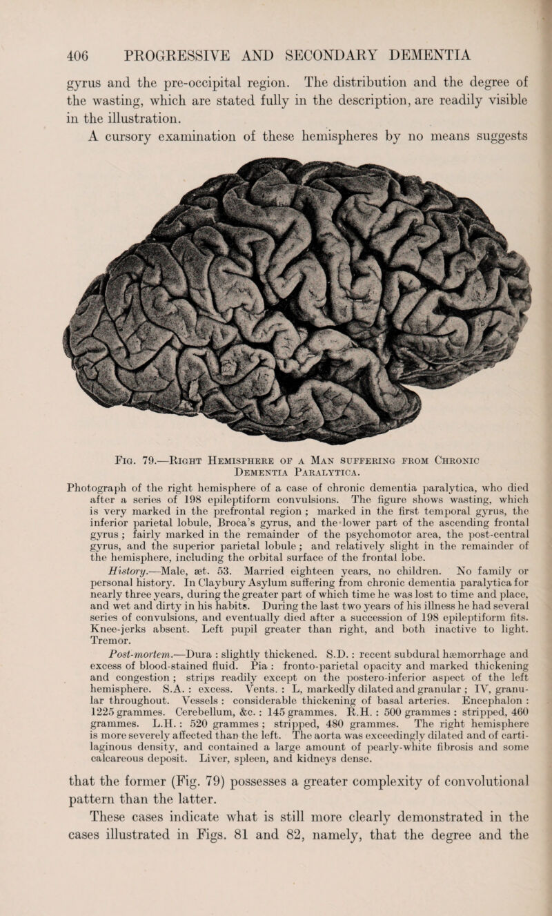 gyrus and the pre-occipital region. The distribution and the degree of the wasting, which are stated fully in the description, are readily visible in the illustration. A cursory examination of these hemispheres by no means suggests Fig. 79.—Right Hemisphere of a Man suffering from Chronic Dementia Paralytica. Photograph of the right hemisphere of a case of chronic dementia paralytica, who died after a series of 198 epileptiform convulsions. The figure shows wasting, which is very marked in the prefrontal region ; marked in the first temporal gyrus, the inferior parietal lobule, Broca’s gyrus, and the lower part of the ascending frontal gyrus ; fairly marked in the remainder of the psychomotor area, the iDOst-central gyrus, and the superior parietal lobule ; and relatively slight in the remainder of the hemisphere, including the orbital surface of the frontal lobe. History.—Male, set. 53. Married eighteen years, no children. No family or personal history. In Claybury Asylum suffering from chronic dementia paralytica for nearly three years, during the greater part of which time he was lost to time and place, and wet and dirt}7 in his habits. During the last two years of his illness he had several series of convulsions, and eventually died after a succession of 198 epileptiform fits. Knee-jerks absent. Left pupil greater than right, and both inactive to light. Tremor. Post-mortem.—Dura : slightly thickened. S.D. : recent subdural haemorrhage and excess of blood-stained fluid. Pia : fronto-parietal opacity and marked thickening and congestion ; strips readily except on the postero-inferior aspect of the left hemisphere. S.A. : excess. Vents.: L, markedly dilated and granular ; IV, granu¬ lar throughout. Vessels : considerable thickening of basal arteries. Encephalon : 1225 grammes. Cerebellum, &c. : 145 grammes. R.H. : 500 grammes : stripped, 460 grammes. L.H. : 520 grammes ; stripped, 480 grammes. The right hemisphere is more severely affected than the left. The aorta was exceedingly dilated and of carti¬ laginous density, and contained a large amount of pearly-white fibrosis and some calcareous deposit. Liver, spleen, and kidneys dense. that the former (Fig. 79) possesses a greater complexity of convolutional pattern than the latter. These cases indicate what is still more clearly demonstrated in the cases illustrated in Figs. 81 and 82, namely, that the degree and the