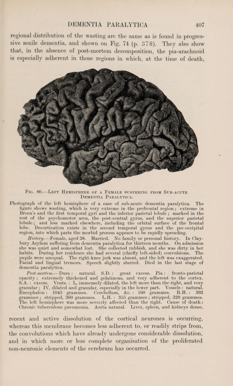 regional distribution of the wasting are the same as is found in progres¬ sive senile dementia, and shown on Fig. 74 (p. 378). They also show that, in the absence of post-mortem decomposition, the pia-arachnoid is especially adherent in those regions in which, at the time of death, Fig. 80.—Left Hemisphere of a Female suffering from Sub-acute Dementia Paralytica. Photograph of the left hemisphere of a case of sub-acute dementia paralytica. The figure shows wasting, which is very extreme in the prefrontal region ; extreme in Broca’s and the first temporal gyri and the inferior parietal lobule ; marked in the rest of the psychomotor area, the post-central gyrus, and the superior parietal lobule; and less marked elsewhere, including the orbital surface of the frontal lobe. Decortication exists in the second temporal gyrus and the pre-occipital region, into which parts the morbid process appears to be rapidly spreading. History.—Female, aged 38. Married. No family or personal history. In Clay- bury Asylum suffering from dementia paralytica for thirteen months. On admission she was quiet and somewhat lost. She collected rubbish, and she was dirty in her habits. During her residence she had several (chiefly left-sided) convulsions. The pupils were unequal. The right-knee jerk was absent, and the left was exaggerated. Facial and lingual tremors. Speech slightly slurred. Died in the last stage of dementia paralytica. Post-mortem.—Dura : natural. S.D. : great excess. Pia : fronto-parietal opacity ; extremely thickened and gelatinous, and very adherent to the cortex. S.A. : excess. Vents. : L, immensely dilated, the left more than the right, and very granular ; IV, dilated and granular, especially in the lower part. Vessels : natural. Encephalon: 1045 grammes. Cerebellum, &c. : 160 grammes. R.H. : 393 grammes ; stripped, 360 grammes. L.H. : 355 grammes ; stripped, 320 grammes. The left hemisphere was more severely affected than the right. Cause of death : Chronic tuberculous pneumonia. Aorta natural. Liver, spleen, and kidneys dense. recent and active dissolution of the cortical neurones is occurring, whereas this membrane becomes less adherent to, or readily strips from, the convolutions which have already undergone considerable dissolution, and in which more or less complete organisation of the proliferated non-neuronic elements of the cerebrum has occurred.