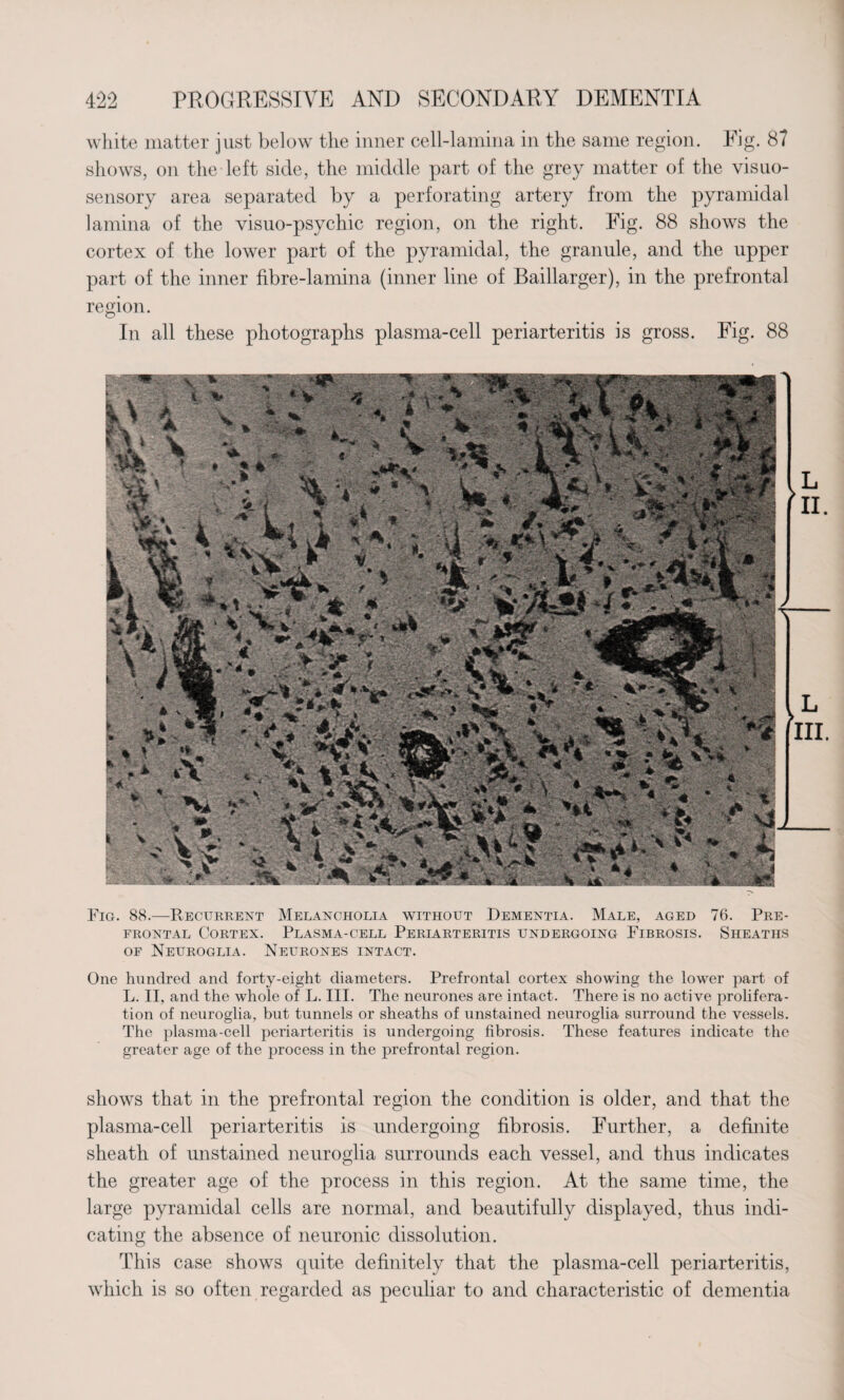 white matter just below the inner cell-lamina in the same region. Fig. 87 shows, on the left side, the middle part of the grey matter of the visuo- sensory area separated by a perforating artery from the pyramidal lamina of the visuo-psychic region, on the right. Fig. 88 shows the cortex of the lower part of the pyramidal, the granule, and the upper part of the inner fibre-lamina (inner line of Baillarger), in the prefrontal region. In all these photographs plasma-cell periarteritis is gross. Fig. 88 Fig. 88.—Recurrent Melancholia without Dementia. Male, aged 76. Pre¬ frontal Cortex. Plasma-cell Periarteritis undergoing Fibrosis. Sheaths of Neuroglia. Neurones intact. One hundred and forty-eight diameters. Prefrontal cortex showing the lower part of L. II, and the whole of L. III. The neurones are intact. There is no active prolifera¬ tion of neuroglia, but tunnels or sheaths of unstained neuroglia surround the vessels. The plasma-cell periarteritis is undergoing fibrosis. These features indicate the greater age of the process in the prefrontal region. shows that in the prefrontal region the condition is older, and that the plasma-cell periarteritis is undergoing fibrosis. Further, a definite sheath of unstained neuroglia surrounds each vessel, and thus indicates the greater age of the process in this region. At the same time, the large pyramidal cells are normal, and beautifully displayed, thus indi¬ cating the absence of neuronic dissolution. This case shows quite definitely that the plasma-cell periarteritis, which is so often regarded as peculiar to and characteristic of dementia