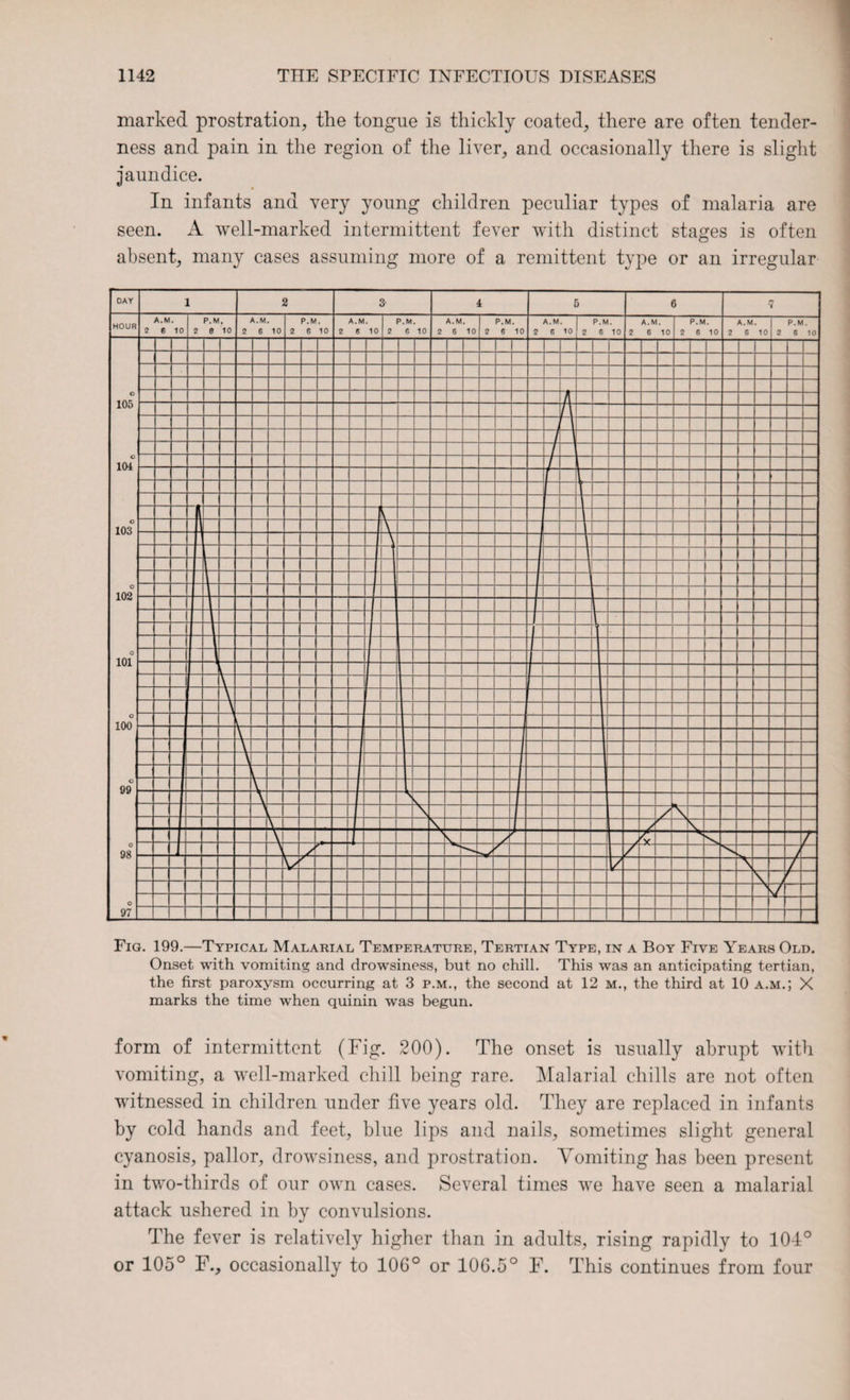 marked prostration, the tongue is thickly coated, there are often tender¬ ness and pain in the region of the liver, and occasionally there is slight jaundice. In infants and very young children peculiar types of malaria are seen. A well-marked intermittent fever with distinct stages is often absent, many cases assuming more of a remittent type or an irregular Fig. 199.—Typical Malarial Temperature, Tertian Type, in a Boy Five Years Old. Onset with vomiting and drowsiness, but no chill. This was an anticipating tertian, the first paroxysm occurring at 3 p.m., the second at 12 m., the third at 10 a.m.; X marks the time when quinin was begun. form of intermittent (Fig. 200). The onset is usually abrupt with vomiting, a well-marked chill being rare. Malarial chills are not often witnessed in children under five years old. They are replaced in infants by cold hands and feet, blue lips and nails, sometimes slight general cyanosis, pallor, drowsiness, and prostration. Vomiting has been present in two-thirds of our own cases. Several times we have seen a malarial attack ushered in by convulsions. The fever is relatively higher than in adults, rising rapidly to 104° or 105° F., occasionally to 100° or 106.5° F. This continues from four