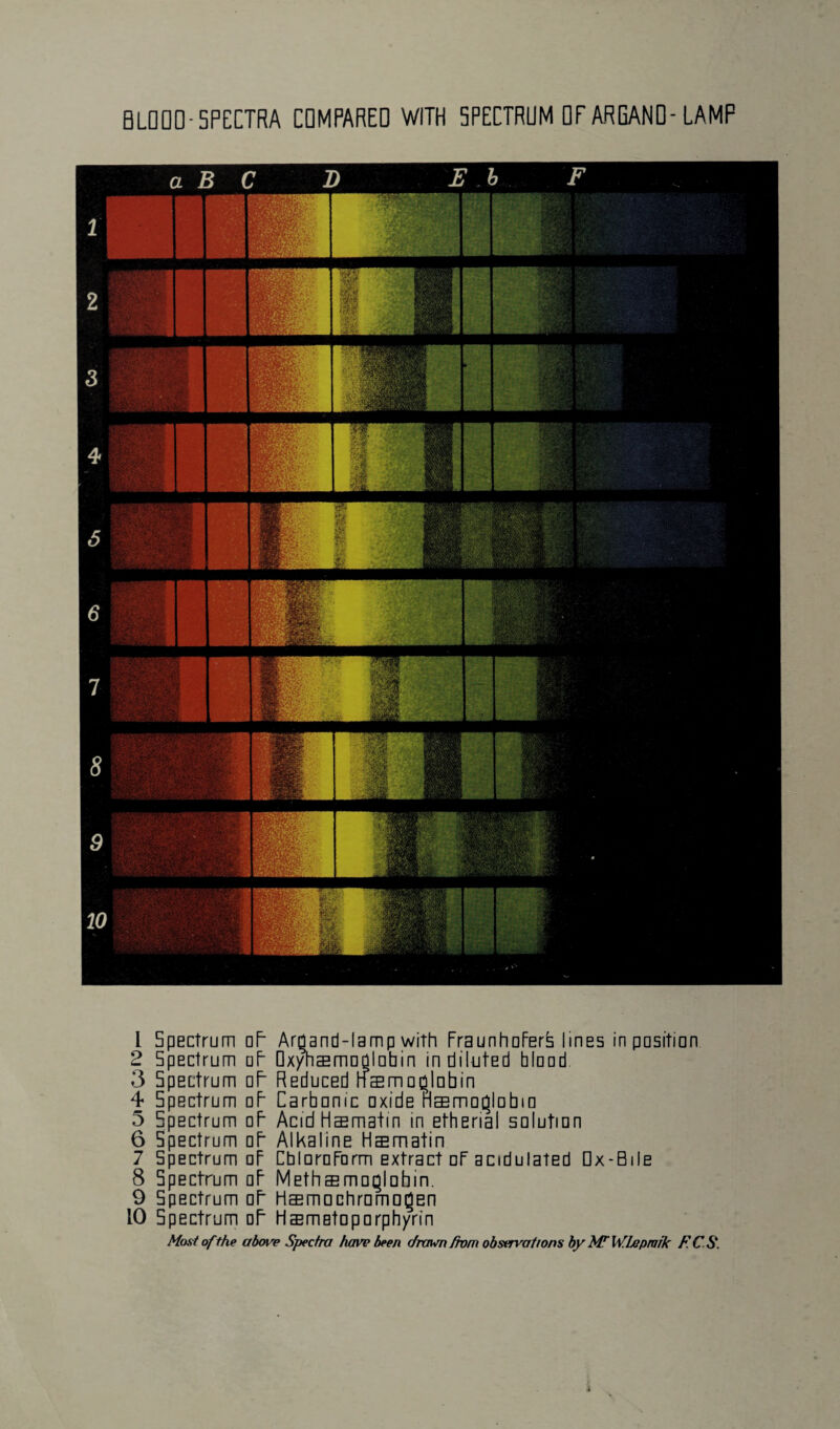 BLOOD-SPECTRA COMPARED WITH SPECTRUM OF ARGAND-LAMP 1 Spectrum oF Arqand-lamp with FraunhoFerb lines in position 2 Spectrum oF Oxyhsmodlobin in diluted blood 3 5pectrum oF Reduced nsmoqlobin 4 Spectrum oF Carbonic oxide Haemoglobin 5 Spectrum oF Acid Hsmatin in etherial solution 6 Spectrum oF Alkaline Hsmatin 7 Spectrum oF CbloroForm extract oF acidulated Dx-Bile 8 Spectrum oF Methsmoqlohin. 9 Spectrum oF Hffimochromo§en 10 Spectrum dF Hsmetoporphyrin Most of the above Spectra have been drawn from observations by Mr WLepraik FCS.