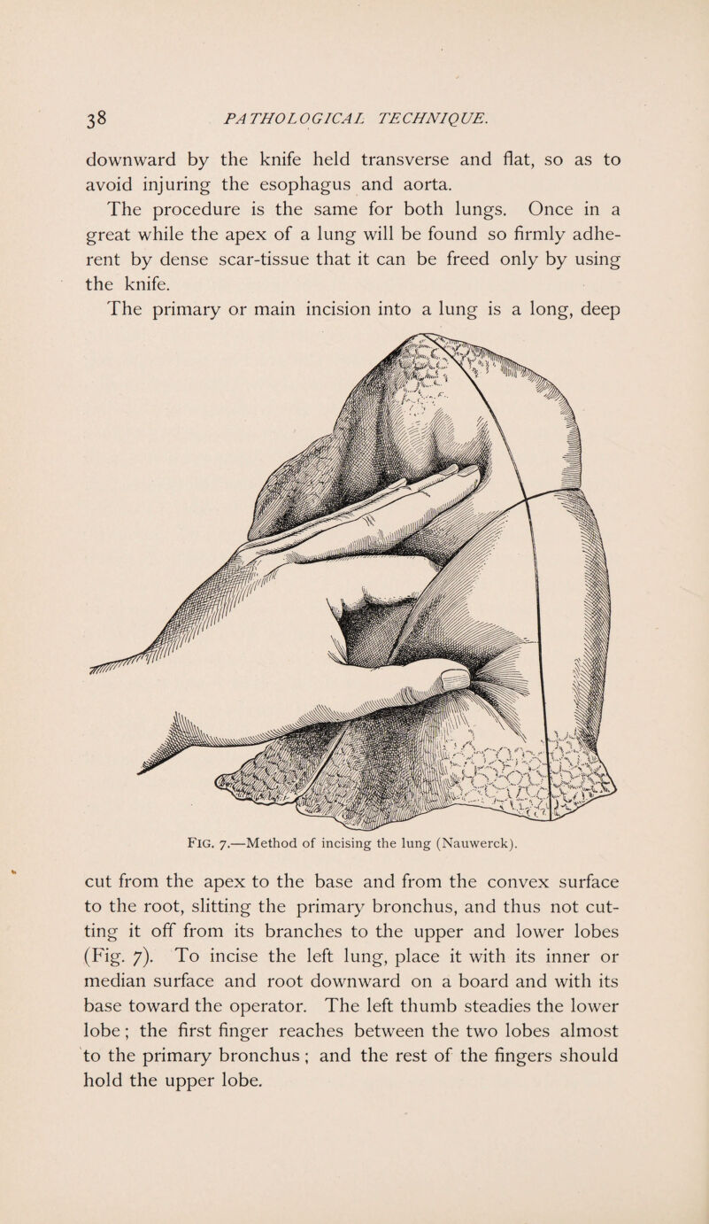 downward by the knife held transverse and flat, so as to avoid injuring the esophagus and aorta. The procedure is the same for both lungs. Once in a great while the apex of a lung will be found so firmly adhe¬ rent by dense scar-tissue that it can be freed only by using the knife. The primary or main incision into a lung is a long, deep cut from the apex to the base and from the convex surface to the root, slitting the primary bronchus, and thus not cut¬ ting it off from its branches to the upper and lower lobes (Fig. 7). To incise the left lung, place it with its inner or median surface and root downward on a board and with its base toward the operator. The left thumb steadies the lower lobe; the first finger reaches between the two lobes almost to the primary bronchus; and the rest of the fingers should hold the upper lobe.