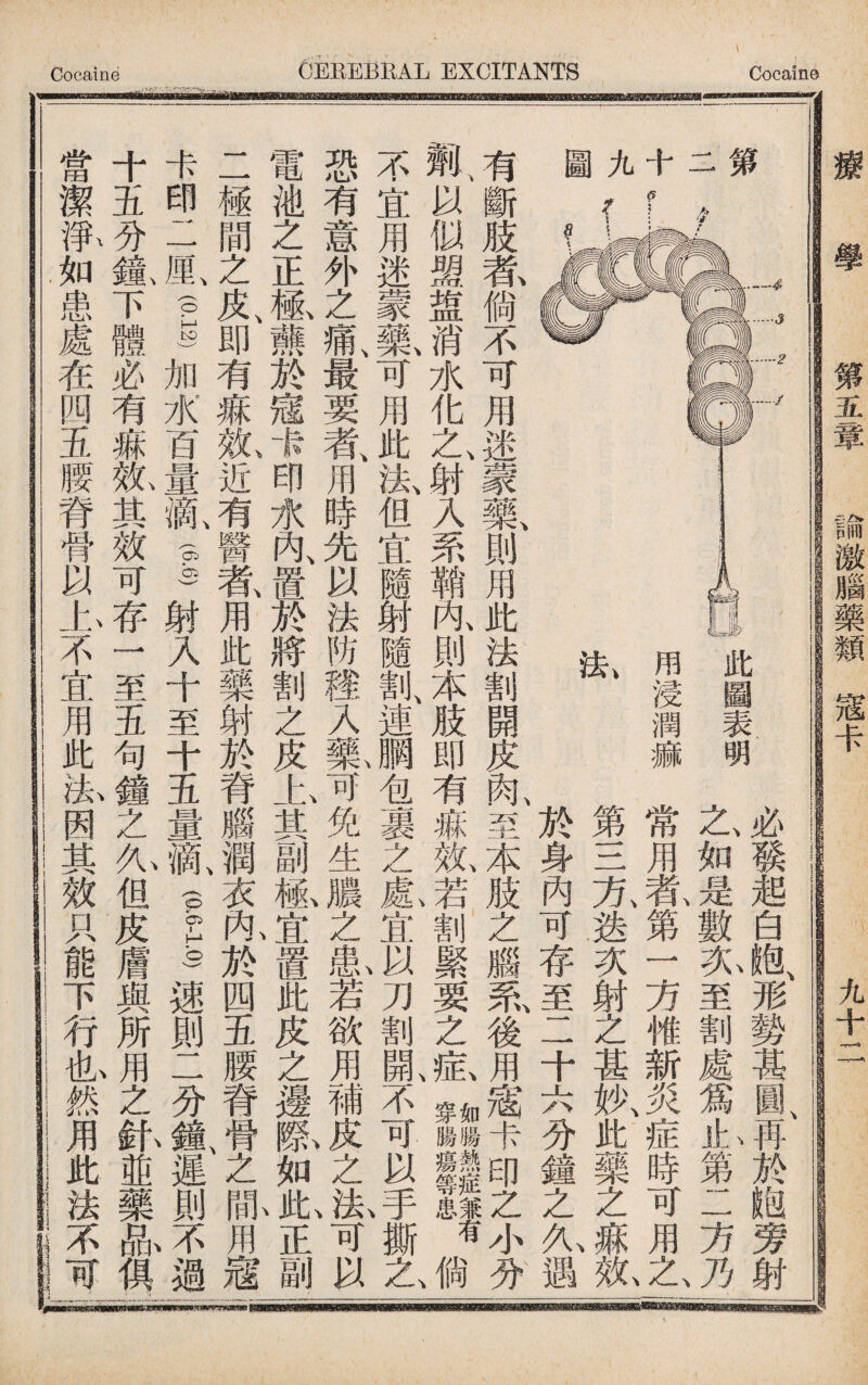 _____ ___ _ 一 療學 第五章 ■激腦藥類寇卡 九十二 ei 此圖表明 用浸潤痲 必琰起白胞形勢甚圓再於_旁射 之如是數炎至割處爲l第二方4 常用敦第一方惟新炎症時可用之、 第三亢迭次射之甚妙、此藥之i氣 於身內可存至二十六分鐘之九遇 有斷肢蓖倘不可用迷蒙||則用此法割開皮亂至本肢之腦系、後用071I:E:EpcZ小分 鼽、以似盟盥消水化之、射入系鞘咏則本肢即有痳齓3割緊要之龙llll^lJ 不宜用迷蒙氣可用此法¥宜隨射隨&連酬包裹之龜宜A刀割既不可以#撕之 恐有意外之痛、最要者、用時先以法防種入氟可免生膿之I若欲用補>^之J可以 電池之正極藤於宼卡_水內、置於將割之皮上其副祗宜置此皮之邊嗯如1正副， 二極間之皮、即有麻氣近有醫獄用此藥射於脊®潤衣咏於四五腰脊骨、之咏用宼 卡印二厘> 运加水百量氣I射入十至十五量氣？1.0)速則二分氟遲則不過 十五分龜下體必有痲亂其效可存一至五句鐘之九但皮膚與所J之釙並藥n|俱| 當潔取如患處在四五腰脊骨以上不宜用此A因其效只能下行也然用此法不可一