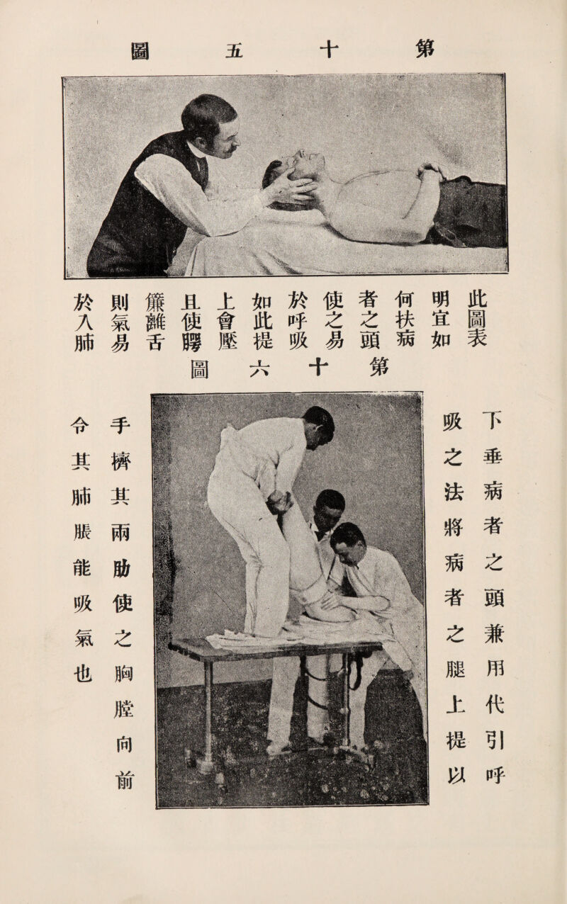 第 五 .V,’ “\f ^n - sg¥f$#vt- ij:: •w. .1 r..v 此圖表 明宜如 何扶病 者之頭第 使之易 於呼吸 如此提六 上會壓 且使腭圖 簾離舌 則氣易 於入肺 下垂病者之頭兼用代引呼 吸之法將病者之腿上提以 手擠其兩肋使之胸膛向前 令其肺脹能吸氣也