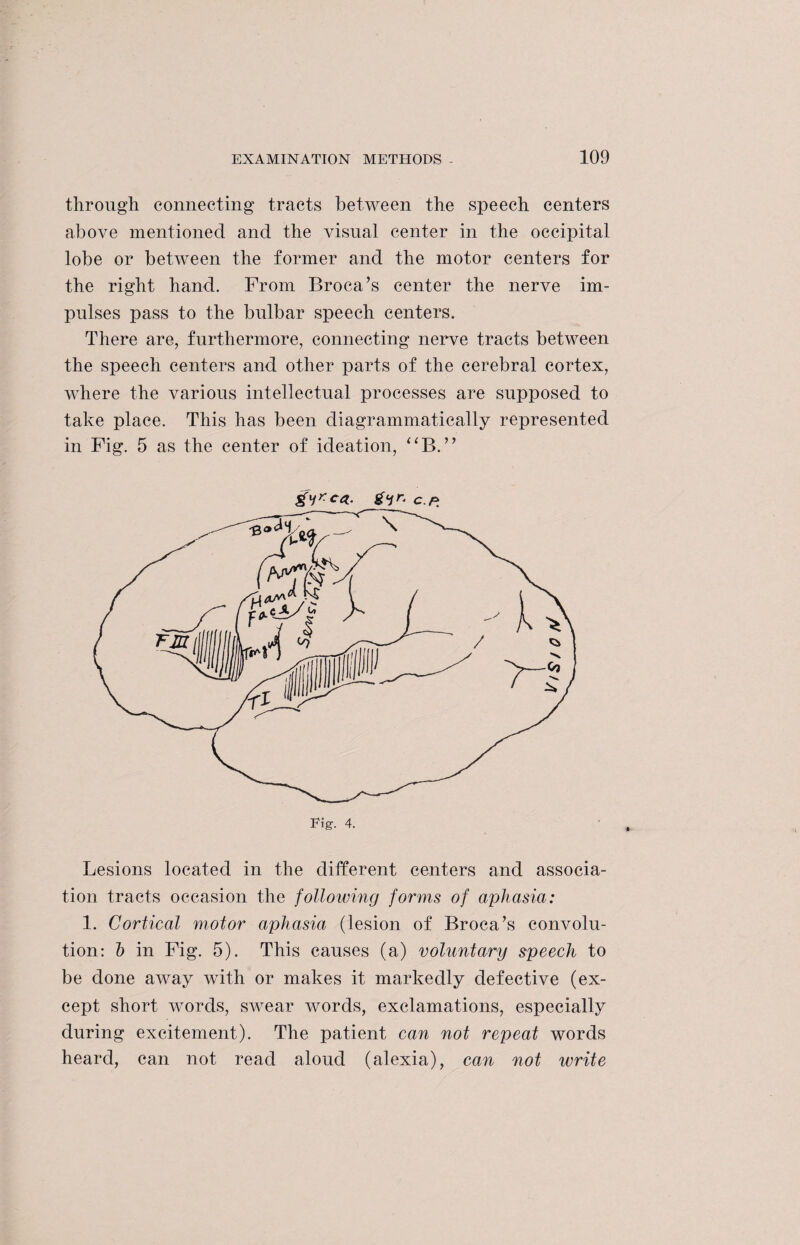 through connecting tracts between the speech centers above mentioned and the visual center in the occipital lobe or between the former and the motor centers for the right hand. From Broca’s center the nerve im¬ pulses pass to the bulbar speech centers. There are, furthermore, connecting nerve tracts between the speech centers and other parts of the cerebral cortex, where the various intellectual processes are supposed to take place. This has been diagrammatically represented in Fig. 5 as the center of ideation, “B. ” gyr. c p Lesions located in the different centers and associa¬ tion tracts occasion the following forms of aphasia: 1. Cortical motor aphasia (lesion of Broca’s convolu¬ tion: b in Fig. 5). This causes (a) voluntary speech to be done away with or makes it markedly defective (ex¬ cept short words, swear words, exclamations, especially during excitement). The patient can not repeat words heard, can not read aloud (alexia), can not write