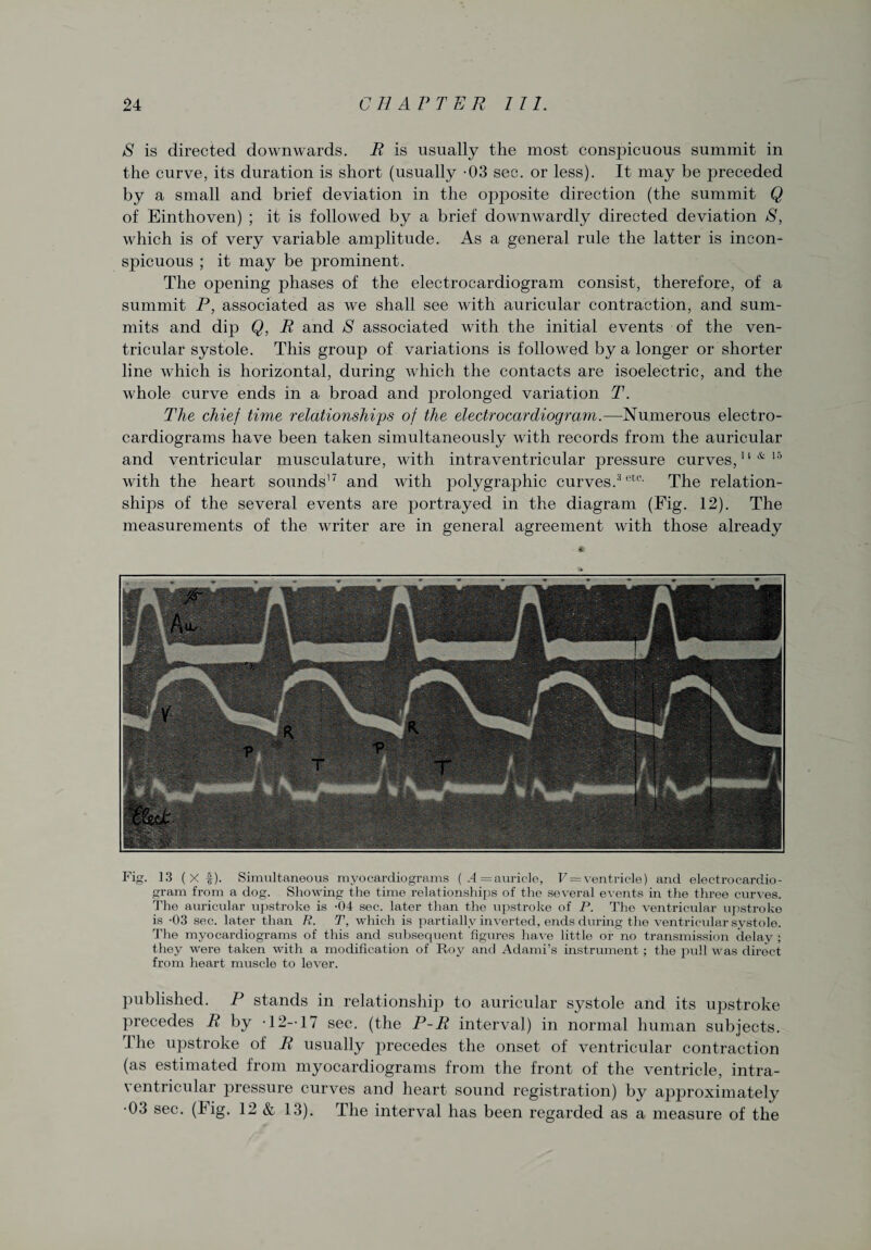 S is directed downwards. R is usually the most consjucuous summit in the curve, its duration is short (usually -03 sec. or less). It may be joreceded by a small and brief deviation in the opposite direction (the summit Q of Einthoven) ; it is followed by a brief downwardly directed deviation S, which is of very variable amplitude. As a general rule the latter is incon¬ spicuous ; it may be prominent. The opening phases of the electrocardiogram consist, therefore, of a summit P, associated as we shall see with auricular contraction, and sum¬ mits and dip Q, R and S associated with the initial events of the ven¬ tricular systole. This group of variations is followed by a longer or shorter line which is horizontal, during which the contacts are isoelectric, and the whole curve ends in a broad and j)rolonged variation T. The chief time relationships of the electrocardiogram.—Numerous electro¬ cardiograms have been taken simultaneously with records from the auricular and ventricular musculature, with intraventricular pressure curves,11 & 15 with the heart sounds17 and with polygraphic curves.3 ete- The relation¬ ships of the several events are portrayed in the diagram (Fig. 12). The measurements of the writer are in general agreement with those already Fig. 13 (X |). Simultaneous myocardiograms (.4= auricle, F = ventricle) and electrocardio¬ gram from a dog. Showing the time relationships of the several events in the three curves. The auricular upstroke is -04 sec. later than the upstroke of P. The ventricular upstroke is -03 sec. later than R. T, which is partially inverted, ends during the ventricular systole. The myocardiograms of this and subsequent figures have little or no transmission delay ; they were taken with a modification of Roy and Adami’s instrument ; the pull was direct from heart muscle to lever. published. P stands in relationship to auricular systole and its upstroke precedes R by -12-17 sec. (the P-R interval) in normal human subjects, f ile upstroke of R usually jirecedes the onset of ventricular contraction (as estimated from myocardiograms from the front of the ventricle, intra¬ ventricular pressure curves and heart sound registration) by approximately •03 sec. (big. 12 & 13). The interval has been regarded as a measure of the