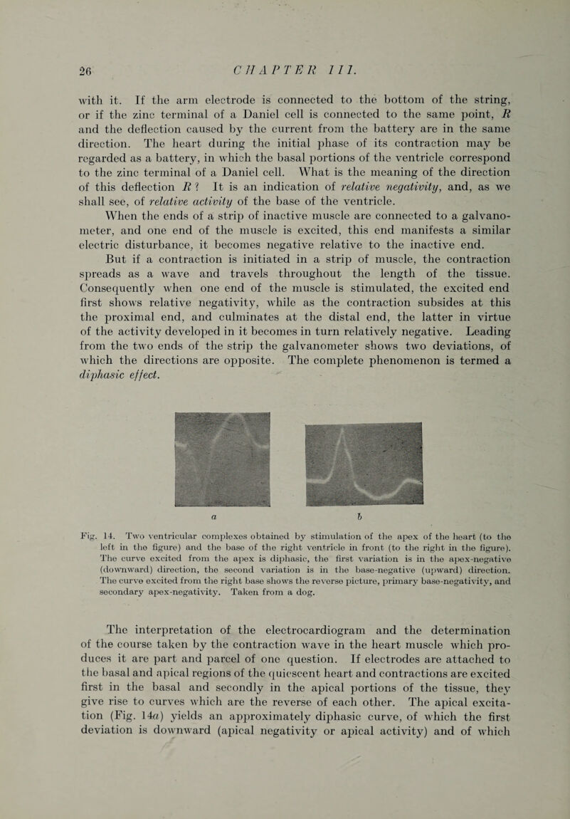 with it. If the arm electrode is connected to the bottom of the string, or if the zinc terminal of a Daniel cell is connected to the same point, R and the deflection caused by the current from the battery are in the same direction. The heart during the initial phase of its contraction may be regarded as a battery, in which the basal portions of the ventricle correspond to the zinc terminal of a Daniel cell. What is the meaning of the direction of this deflection R ? It is an indication of relative negativity, and, as we shall see, of relative activity of the base of the ventricle. When the ends of a strip of inactive muscle are connected to a galvano¬ meter, and one end of the muscle is excited, this end manifests a similar electric disturbance, it becomes negative relative to the inactive end. But if a contraction is initiated in a strip) of muscle, the contraction spreads as a wave and travels throughout the length of the tissue. Consequently when one end of the muscle is stimulated, the excited end first shows relative negativity, while as the contraction subsides at this the proximal end, and culminates at the distal end, the latter in virtue of the activity developed in it becomes in turn relatively negative. Leading from the two ends of the strip the galvanometer shows two deviations, of which the directions are opposite. The complete phenomenon is termed a diphasic effect. Fig. 14. Two ventricular complexes obtained by stimulation of the apex of the heart (to the left in the figure) and the base of the right ventricle in front (to the right in the figure). The curve excited from the apex is diphasic, the first variation is in the apex-negative (downward) direction, the second variation is in the base-negative (upward) direction. The curve excited from the right base shows the reverse picture, primary base-negativity, and secondary apex-negativity. Taken from a dog. The interpretation of the electrocardiogram and the determination of the course taken by the contraction wave in the heart muscle which pro¬ duces it are part and parcel of one question. If electrodes are attached to the basal and apical regions of the quiescent heart and contractions are excited first in the basal and secondly in the apical portions of the tissue, they give rise to curves which are the reverse of each other. The ajhcal excita¬ tion (Fig. 14a) yields an approximately diphasic curve, of which the first deviation is downward (apical negativity or apical activity) and of which