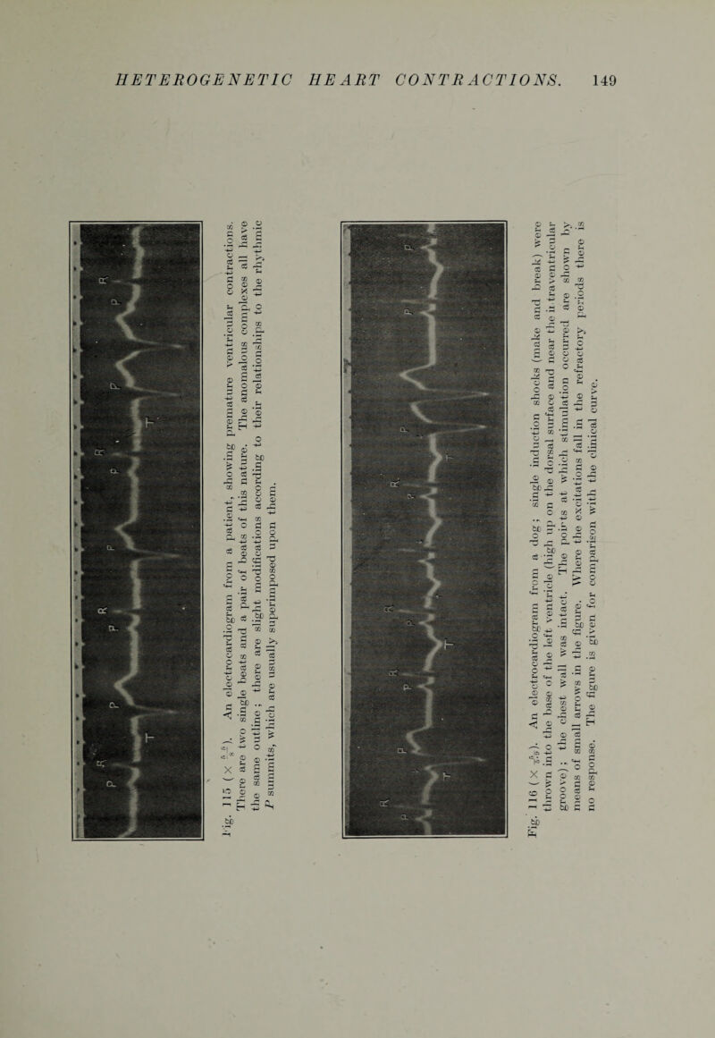 (X -£?)■ An electrocardiogram from a dog; single induction shocks (make and break) were thrown into the base of the left ventricle (high up on the dorsal surface and near the intraventricular groove); the chest wall was intact. The points at which stimulation occurred are shown by means of small arrows in the figure. Where the excitations fall in the refractory periods there is no response. The figure is given for comparison with the clinical curve.