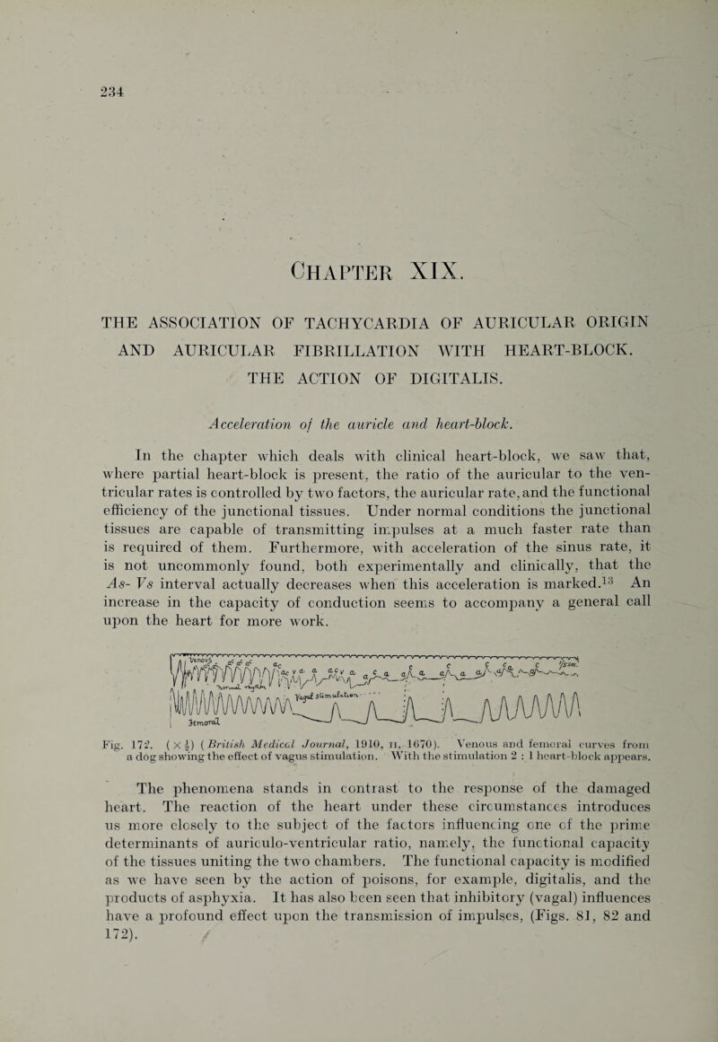 Chapter XIX. THE ASSOCIATION OF TACHYCARDIA OF AURICULAR ORIGIN AND AURICULAR FIBRILLATION WITH HEART-BLOCK. THE ACTION OF DIGITALIS. Acceleration of the auricle and heart-block. In the chapter which deals with clinical heart-block, we saw that, where partial heart-block is present, the ratio of the auricular to the ven¬ tricular rates is controlled by two factors, the auricular rate, and the functional efficiency of the junctional tissues. Under normal conditions the junctional tissues are capable of transmitting impulses at a much faster rate than is required of them. Furthermore, with acceleration of the sinus rate, it is not uncommonly found, both experimentally and clinically, that the As- Vs interval actually decreases when this acceleration is marked.13 An increase in the capacity of conduction seems to accompany a general call upon the heart for more work. Fig. 172. (Xj) ( British Medical Journal, 1910, ii, 1670), Venous and femoral curves from a dog showing the effect of vagus stimulation. With the stimulation 2 : 1 heart-block appears. The phenomena stands in contrast to the response of the damaged heart. The reaction of the heart under these circumstances introduces us more closely to the subject of the factors influencing one of the prime determinants of auriculo-ventricular ratio, namely, the functional capacity of the tissues uniting the two chambers. The functional capacity is modified as we have seen by the action of poisons, for example, digitalis, and the products of asphyxia. It has also been seen that inhibitory (vagal) influences have a profound effect upon the transmission of impulses, (Figs. 81, 82 and 172).