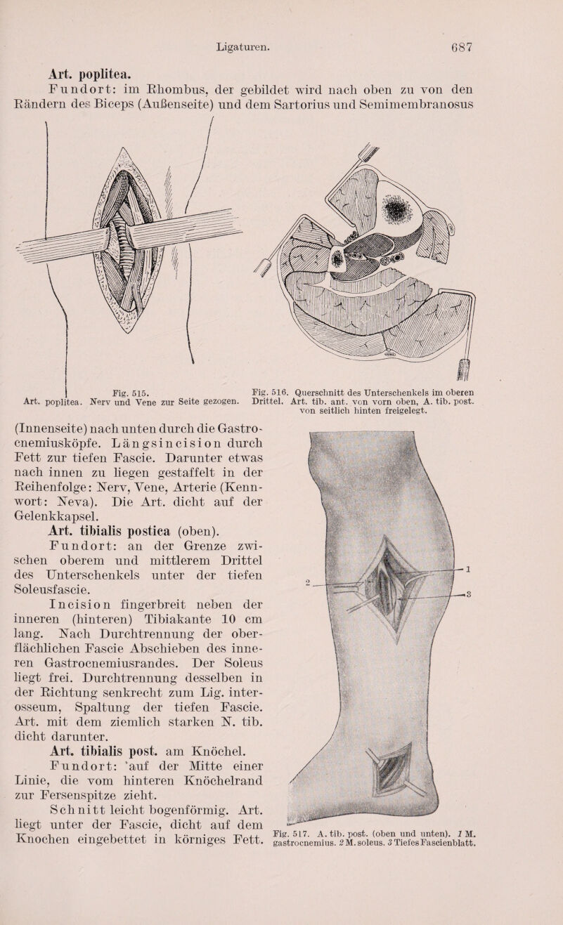 Art. poplitea. Fundort: im Rhombus, der gebildet wird nach oben zu von den Rändern des Biceps (Außenseite) und dem Sartorius und Semimembranosus Fig. 515. Art. poplitea. Nerv und Vene zur Seite gezogen. Fig. 516. Querschnitt des Unterschenkels im oberen Drittel. Art. tib. ant. von vorn oben, A. tib. post, von seitlich hinten freigelegt. (Innenseite) nach unten durch die Gastro - cnemiusköpfe. Längsincision durch Fett zur tiefen Fascie. Darunter etwas nach innen zu liegen gestaffelt in der Reihenfolge: Kerv, Vene, Arterie (Kenn¬ wort: Keva). Die Art. dicht auf der Gelenkkapsel. Art. tibialis postica (oben). Fundort: an der Grenze zwi¬ schen oberem und mittlerem Drittel des Unterschenkels unter der tiefen Soleusfaseie. Incision fingerbreit neben der inneren (hinteren) Tibiakante 10 cm lang. Kach Durchtrennung der ober¬ flächlichen Fascie Abschieben des inne¬ ren Gastrocnemiusrandes. Der Soleus liegt frei. Durchtrennung desselben in der Richtung senkrecht zum Lig. inter- osseum, Spaltung der tiefen Fascie. Art. mit dem ziemlich starken K. tib. dicht darunter. Art. tibialis post, am Knöchel. Fundort: 'auf der Mitte einer Linie, die vom hinteren Knöchelrand zur Fersenspitze zieht. Schnitt leicht bogenförmig. Art. liegt unter der Fascie, dicht auf dem Knochen eingebettet in körniges Fett. Fig. 517. A. tib. post, (oben und unten). 1 M. gastrocnemius. 2 M. soleus. 3 TiefesFascienblatt.