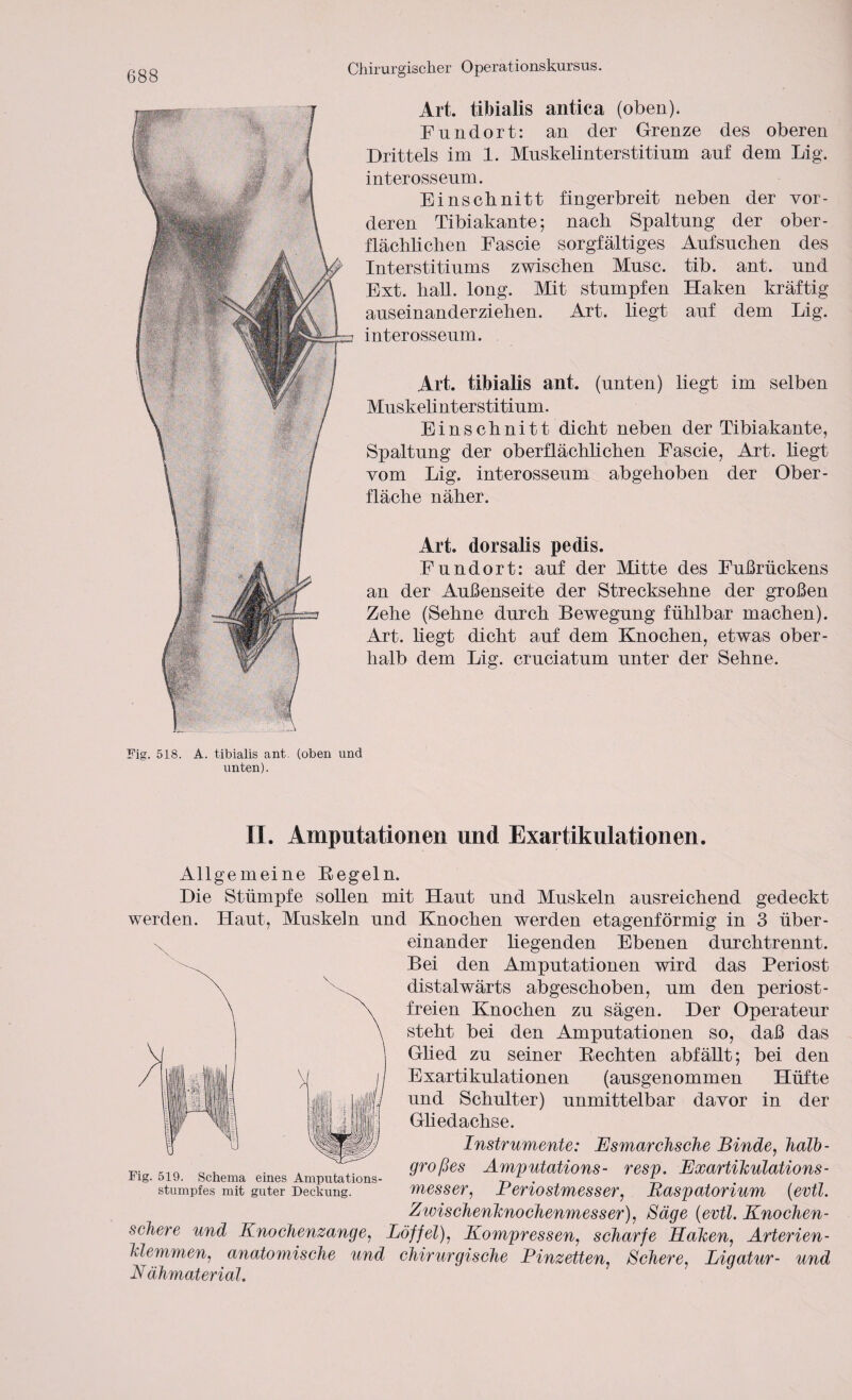 Art. tibialis antica (oben). Fundort: an der Grenze des oberen Drittels im 1. Muskelinterstitium auf dem Lig. interosseum. Einschnitt fingerbreit neben der vor¬ deren Tibiakante; nach Spaltung der ober¬ flächlichen Fascie sorgfältiges Anfsnchen des Interstitinms zwischen Muse. tib. ant. und Ext. hall. long. Mit stumpfen Haken kräftig auseinander ziehen. Art. liegt auf dem Lig. interosseum. Art. tibialis ant. (unten) liegt im selben Muskelinterstitium. Einschnitt dicht neben der Tibiakante, Spaltung der oberflächlichen Fascie, Art. hegt vom Lig. interosseum abgehoben der Ober¬ fläche näher. Art. dorsalis pedis. Fundort: auf der Mitte des Fußrückens an der Außenseite der Strecksehne der großen Zehe (Sehne durch Bewegung fühlbar machen). Art. hegt dicht auf dem Knochen, etwas ober¬ halb dem Lig. cruciatum unter der Sehne. Fig. 518. A. tibialis ant. (oben und unten). II. Amputationen und Exartikulationen. Allgemeine Kegeln. Die Stümpfe sollen mit Haut und Muskeln ausreichend gedeckt werden. Haut, Muskeln und Knochen werden etagenförmig in 3 über¬ einander hegenden Ebenen durchtrennt. Bei den Amputationen wird das Periost distalwärts abgeschoben, um den periost- freien Knochen zu sägen. Der Operateur steht bei den Amputationen so, daß das Ghed zu seiner Bechten abfällt; bei den Exartikulationen (ausgenommen Hüfte und Schulter) unmittelbar davor in der Ghedachse. Instrumente: Esmarchsche Binde, halb- großes Amputations- resp. Exartikulations- messer, Periostmesser, Raspatorium (evtl. Zwischenknochenmesser), Säge (evtl. Knochen¬ schere und Knochenzange, Löffel), Kompressen, scharfe Haken, Arterien- klemmen, anatomische und chirurgische Pinzetten, Schere, Ligatur- und Nähmaterial. Fig. 519. Schema eines Amputations¬ stumpfes mit guter Deckung.