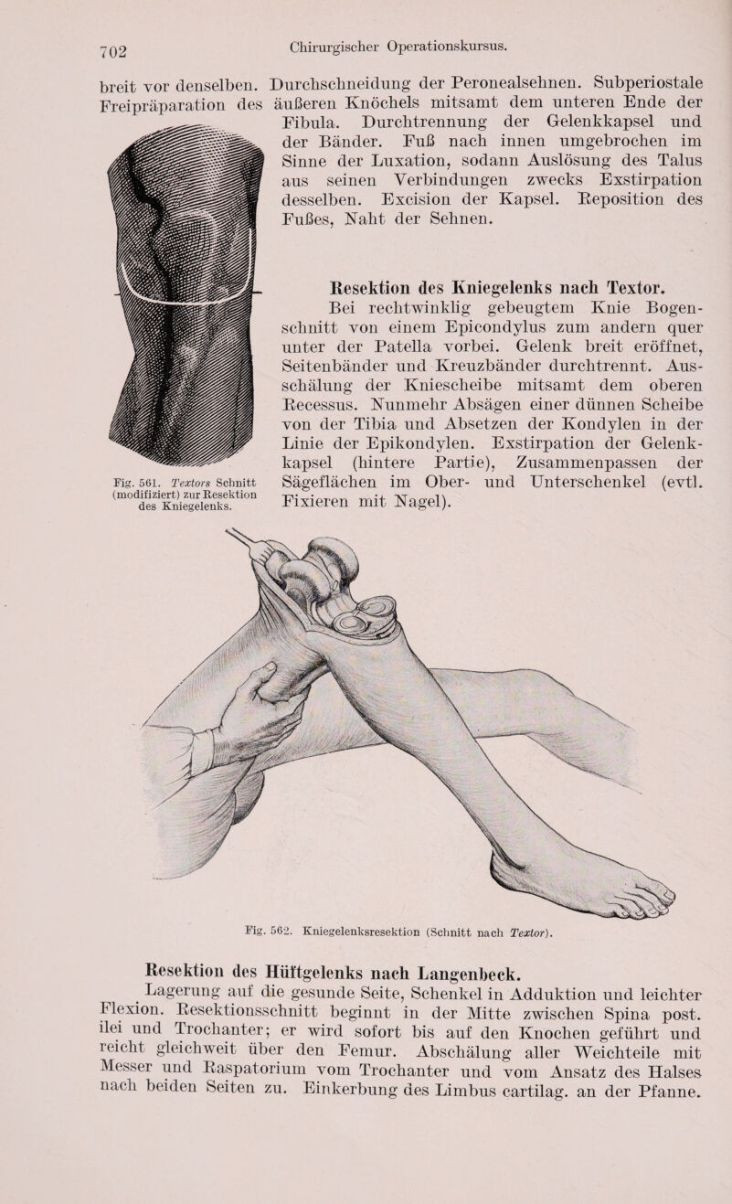 breit vor denselben. Freipräparation des Fig. 561. Textors Schnitt (modifiziert) zur Resektion des Kniegelenks. Durchschneidung der Peronealsehnen. Subperiostale äußeren Knöchels mitsamt dem unteren Ende der Fibula. Durchtrennung der Gelenkkapsel und der Bänder. Fuß nach innen umgebrochen im Sinne der Luxation, sodann Auslösung des Talus aus seinen Verbindungen zwecks Exstirpation desselben. Excision der Kapsel. Beposition des Fußes, Naht der Sehnen. Resektion des Kniegelenks nach Textor. Bei rechtwinklig gebeugtem Knie Bogen¬ schnitt von einem Epicondylus zum andern quer unter der Patella vorbei. Gelenk breit eröffnet, Seitenbänder und Kreuzbänder durch trennt. Aus¬ schälung der Kniescheibe mitsamt dem oberen Becessus. Nunmehr Absägen einer dünnen Scheibe von der Tibia und Absetzen der Kondylen in der Linie der Epikondylen. Exstirpation der Gelenk¬ kapsel (hintere Partie), Zusammenpassen der Sägeflächen im Ober- und Unterschenkel (evtl. Fixieren mit Nagel). Fig. 562. Kniegelenksresektion (Schnitt nach Textor). Resektion des Hüftgelenks nach Langenbeck. # Lagerung auf die gesunde Seite, Schenkel in Adduktion und leichter Flexion. Besektionsschnitt beginnt in der Mitte zwischen Spina post, ilei und Trochanter; er wird sofort bis auf den Knochen geführt und reicht gleich weit über den Femur. Abschälung aller Weichteile mit Messer und Baspatorium vom Trochanter und vom Ansatz des Halses nach beiden Seiten zu. Einkerbung des Limbus cartilag. an der Pfanne.