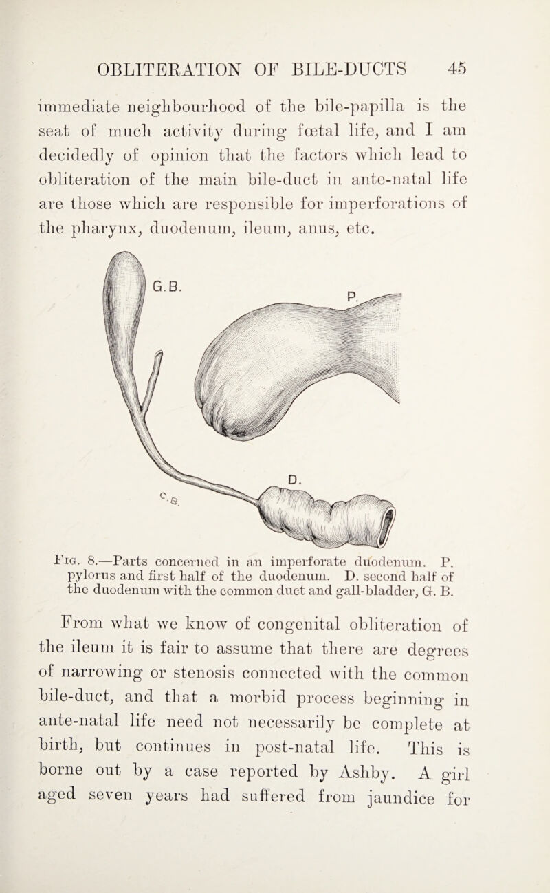 immediate neighbourhood of the bile-papilla is the seat of much activity during foetal life, and I am decidedly of opinion that the factors which lead to obliteration of the main bile-duct in ante-natal life are those which are responsible for imperforations of the pharynx, duodenum, ileum, anus, etc. Fig. 8.—Parts concerned in an imperforate duodenum. P. pylorus and first half of the duodenum. D. second half of the duodenum with the common duct and gall-bladder, G. B. From what we know of congenital obliteration of the ileum it is fair to assume that there are degrees of narrowing or stenosis connected with the common bile-duct, and that a morbid process beginning in ante-natal life need not necessarily be complete at birth, but continues in post-natal life. This is borne out by a case reported by Ashby. A girl aged seven years had suffered from jaundice for