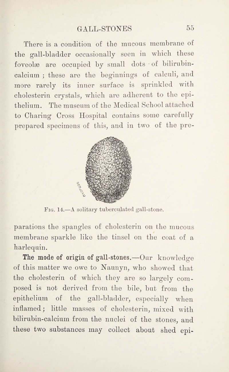 There is a condition of the mucous membrane of the gall-bladder occasionally seen in which these foveolae are occupied by small dots of bilirubin- calcium ; these are the beginnings of calculi, and more rarely its inner surface is sprinkled with cholesterin crystals, which are adherent to the epi¬ thelium. The museum of the Medical School attached to Charing Cross Hospital contains some carefully prepared specimens of this, and in two of the pre- Fig. 14.—A solitary tuberculated gall-stone. parations the spangles of cholesterin on the mucous membrane sparkle like the tinsel on the coat of a harlequin. The mode of origin of gall-stones.—Our knowledge of this matter we owe to Naunyn, who showed that the cholesterin of which they are so largely com¬ posed is not derived from the bile, but from the epithelium of the gall-bladder, especially when inflamed; little masses of cholesterin, mixed with bilirubin-calcium from the nuclei of the stones, and these two substances may collect about shed epi-