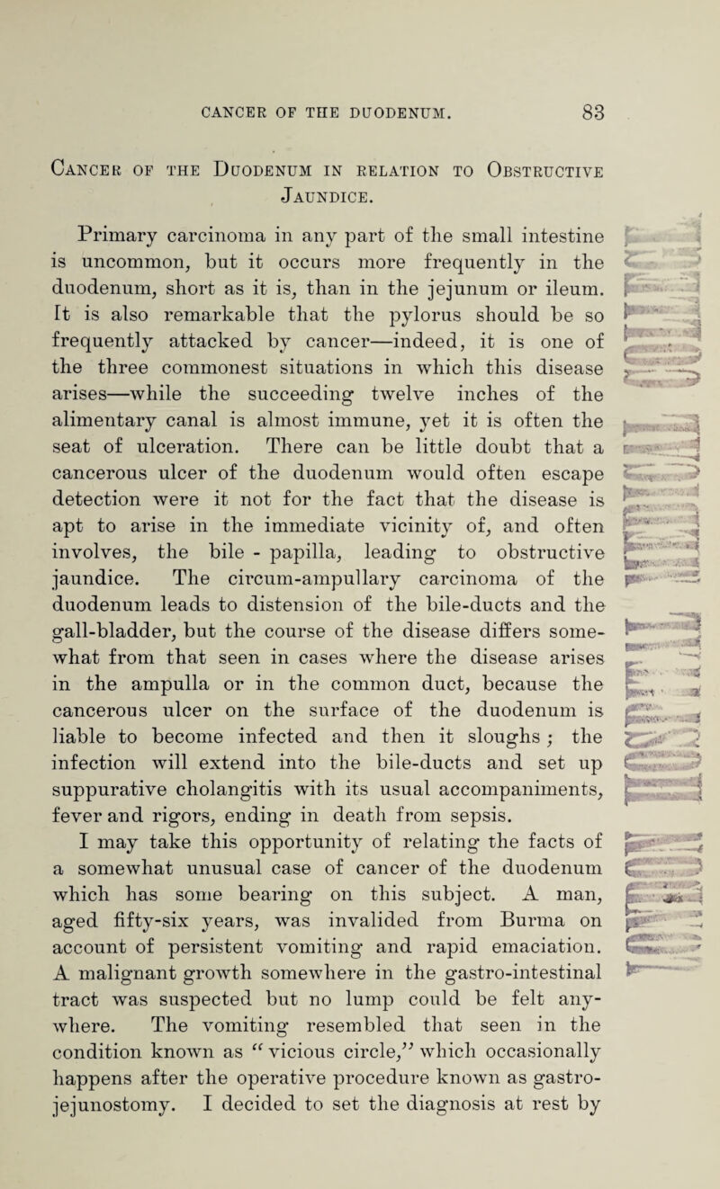 Cancer of the Duodenum in relation to Obstructive Jaundice. Primary carcinoma in any part of the small intestine is uncommon, but it occurs more frequently in the duodenum, short as it is, than in the jejunum or ileum. Tt is also remarkable that the pylorus should be so frequently attacked by cancer—indeed, it is one of the three commonest situations in which this disease arises—while the succeeding twelve inches of the alimentary canal is almost immune, yet it is often the seat of ulceration. There can be little doubt that a cancerous ulcer of the duodenum would often escape detection were it not for the fact that the disease is apt to arise in the immediate vicinity of, and often involves, the bile - papilla, leading to obstructive jaundice. The circum-ampullary carcinoma of the duodenum leads to distension of the bile-ducts and the gall-bladder, but the course of the disease differs some¬ what from that seen in cases where the disease arises in the ampulla or in the common duct, because the cancerous ulcer on the surface of the duodenum is liable to become infected and then it sloughs ; the infection will extend into the bile-ducts and set up suppurative cholangitis with its usual accompaniments, fever and rigors, ending in death from sepsis. I may take this opportunity of relating the facts of a somewhat unusual case of cancer of the duodenum which has some bearing on this subject. A man, aged fifty-six years, was invalided from Burma on account of persistent vomiting and rapid emaciation. A malignant growth somewhere in the gastro-intestinal tract was suspected but no lump could be felt any¬ where. The vomiting resembled that seen in the condition known as “ vicious circle,” which occasionally happens after the operative procedure known as gastro¬ jejunostomy. I decided to set the diagnosis at rest by p- eebm 2<1 ■A 74 to ?.~5 ~v‘ A A to#-* i