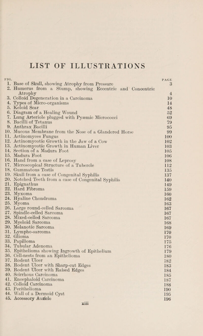 LIST OF ILLUSTRATIONS FIG. PAGE 1. Base of Skull, showing Atrophy from Pressure 3 2. Humerus from a Stump, showing Eccentric and Concentric Atrophy 4 3. Colloid Degeneration in a Carcinoma 10 4. Types of Micro-organisms 14 5. Keloid Scar 48 6. Diagram of a Healing Wound 52 7. Lung Arteriole plugged with Pysemic Micrococci 69 8. Bacilli of Tetanus 79 9. Anthrax Bacilli 95 10. Mucous Membrane from the Nose of a Glandered Horse 99 11. Actinomyces Fungus 100 12. Actinomycotic Growth in the Jaw of a Cow 102 13. Actinomycotic Growth in Human Liver 103 14. Section of a Madura Foot 105 15. Madura Foot 106 16. Hand from a case of Leprosy 108 17. Microscopical Structure of a Tubercle 112 18. Gummatous Testis 135 19. Skull from a case of Congenital Syphilis 137 20. Notched Teeth from a case of Congenital Syphilis 140 21. Epignathus 149 22. Hard Fibroma 159 23. Myxoma 160 24. Hyaline Chondroma 162 25. Myoma 163 26. Large round-celled Sarcoma 167 27. Spindle-celled Sarcoma 167 28. Mixed-celled Sarcoma 167 29. Myeloid Sarcoma 168 30. Melanotic Sarcoma 169 31. Lympho-sarcoma 170 32. Glioma 170 33. Papilloma 175 34. Tubular Adenoma 176 35. Epithelioma showing Ingrowth of Epithelium 179 36. Cell-nests from an Epithelioma 180 37. Rodent Ulcer 182 38. Rodent Ulcer with Sharp-cut Edges 183 39. Rodent Ulcer with Raised Edges 184 40. Scirrhous Carcinoma 185 41. Encephaloid Carcinoma 187 42. Colloid Carcinoma 188 43. Perithelioma 190 44. Wall of a Dermoid Cyst 195 45. Accessory Auricle 195