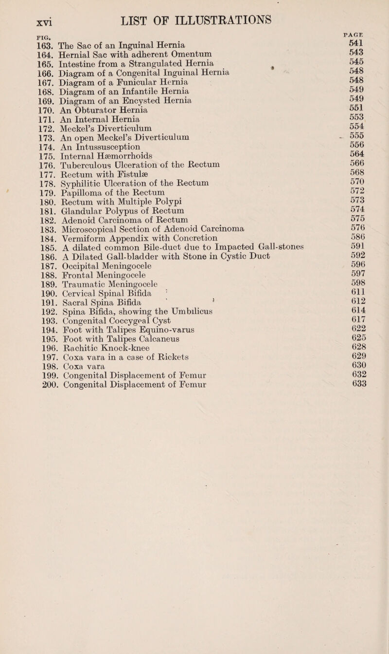 FIG. 163. The Sac of an Inguinal Hernia 164. Hernial Sac with adherent Omentum 165. Intestine from a Strangulated Hernia # 166. Diagram of a Congenital Inguinal Hernia 167. Diagram of a Funicular Hernia 168. Diagram of an Infantile Hernia 169. Diagram of an Encysted Hernia 170. An Obturator Hernia 171. An Internal Hernia 172. Meckel’s Diverticulum 173. An open Meckel’s Diverticulum 174. An Intussusception 175. Internal Haemorrhoids 176. Tuberculous Ulceration of the Rectum 177. Rectum with Fistulse 178. Syphilitic Ulceration of the Rectum 179. Papilloma of the Rectum 180. Rectum with Multiple Polypi 181. Glandular Polypus of Rectum 182. Adenoid Carcinoma of Rectum 183. Microscopical Section of Adenoid Carcinoma 184. Vermiform Appendix with Concretion 185. A dilated common Bile-duct due to Impacted Gall-stones 186. A Dilated Gall-bladder with Stone in Cystic Duct 187. Occipital Meningocele 188. Frontal Meningocele 189. Traumatic Meningocele 190. Cervical Spinal Bifida 191. Sacral Spina Bifida 3 192. Spina Bifida, showing the Umbilicus 193. Congenital Coccygeal Cyst 194. Foot with Talipes Equino-varus 195. Foot with Talipes Calcaneus 196. Rachitic Knock-knee 197. Coxa vara in a case of Rickets 198. Coxa vara 199. Congenital Displacement of Femur 200. Congenital Displacement of Femur PAGE 541 543 545 548 548 549 549 551 553 554 555 556 564 566 568 570 572 573 574 575 576 586 591 592 596 597 598 611 612 614 617 622 625 628 629 630 632 633