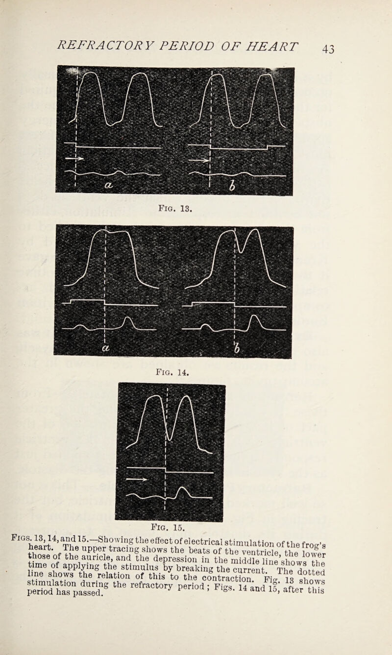 REFRACTORY PERIOD OF HEART Fig. 13. Fig. 14. Fig. 15. Figs 13,14, and 15.—bho wing the effect of el ectrical stimulation of the froo-’s heart. The upper tracing shows the beats of the venSe the Wr those of the auricle, and the depression in the middle line’sliows the time of applying the stimulus by breaking the current The dotted lme shows the relation of this to the contraction F,> is d stimulation during the refractory period • Fi°-s 14 and ifT oft- period has passed. * 1 ’ °s’ 14 and 15> after thls