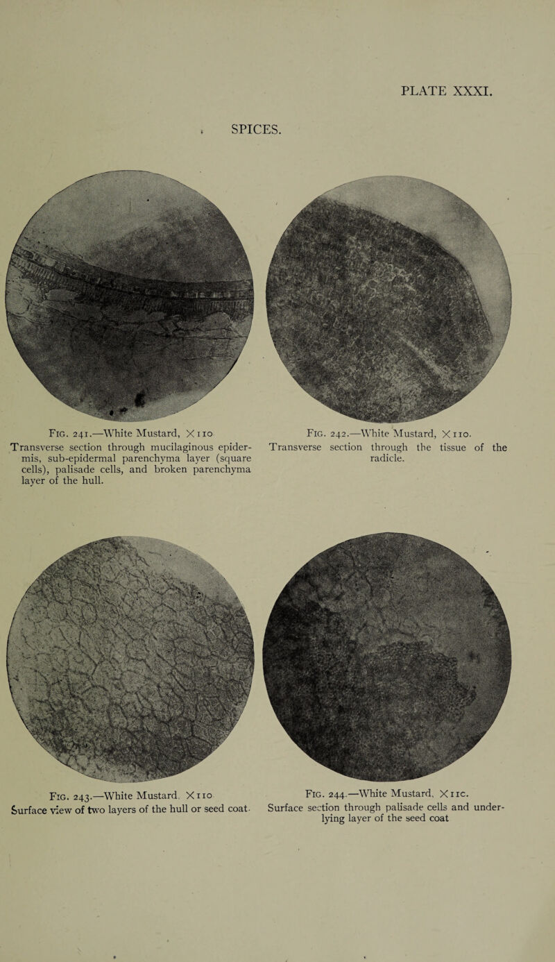 SPICES. Fig. 241.—White Mustard, Xno Transverse section through mucilaginous epider¬ mis, sub-epidermal parenchyma layer (square cells), palisade cells, and broken parenchyma layer of the hull. Fig. 242.—White Mustard, Xno. Transverse section through the tissue of the radicle. Fig. 243.—White Mustard, Xno Surface view of two layers of the hull or seed coat- Fig. 244.—White Mustard, Xnc. Surface section through palisade cells and under¬ lying layer of the seed coat