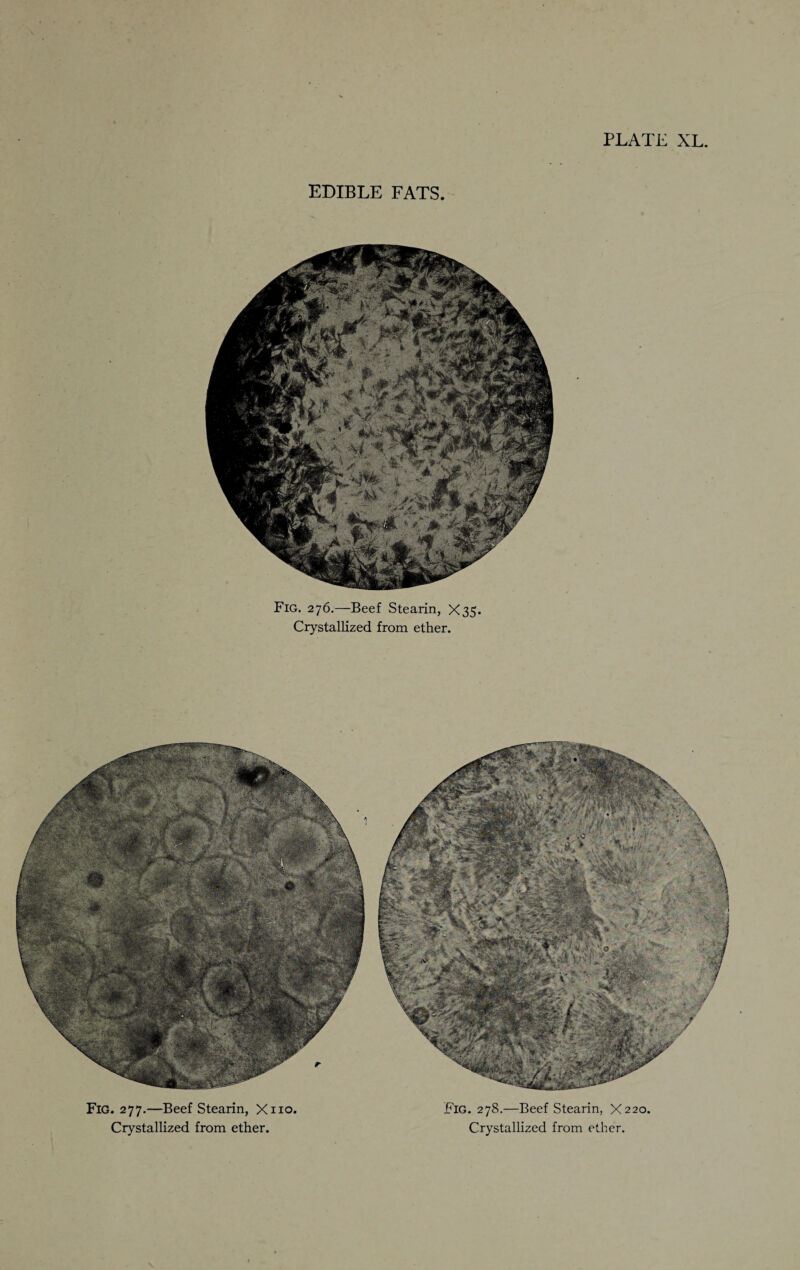 PLATE XL EDIBLE FATS. Fig. 276.—Beef Stearin, X35. Crystallized from ether. Fig. 277.—Beef Stearin, Xno. Fig. 278.—Beef Stearin, X220. Crystallized from ether. Crystallized from ether.